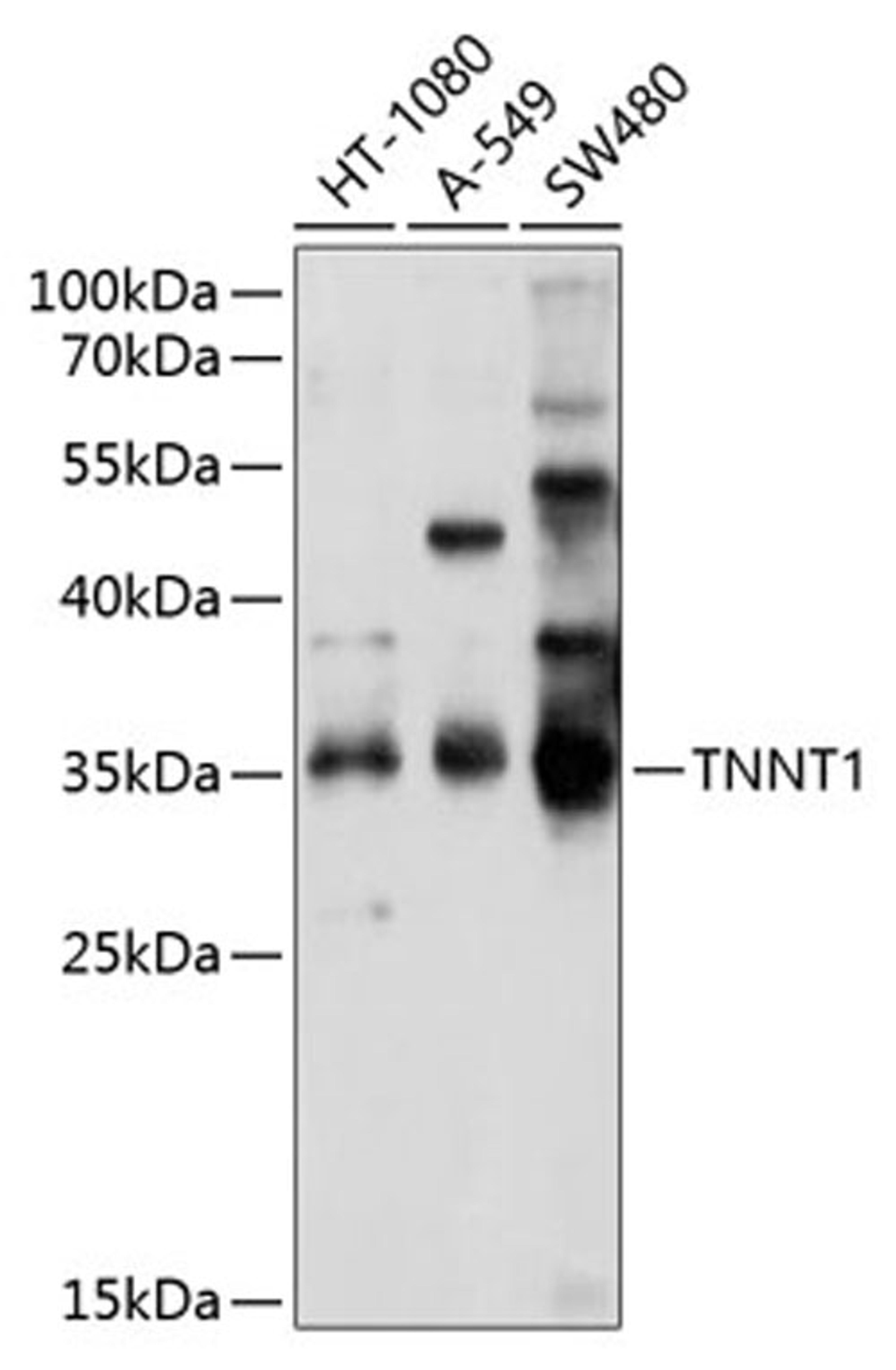 Western blot - TNNT1 antibody (A10354)