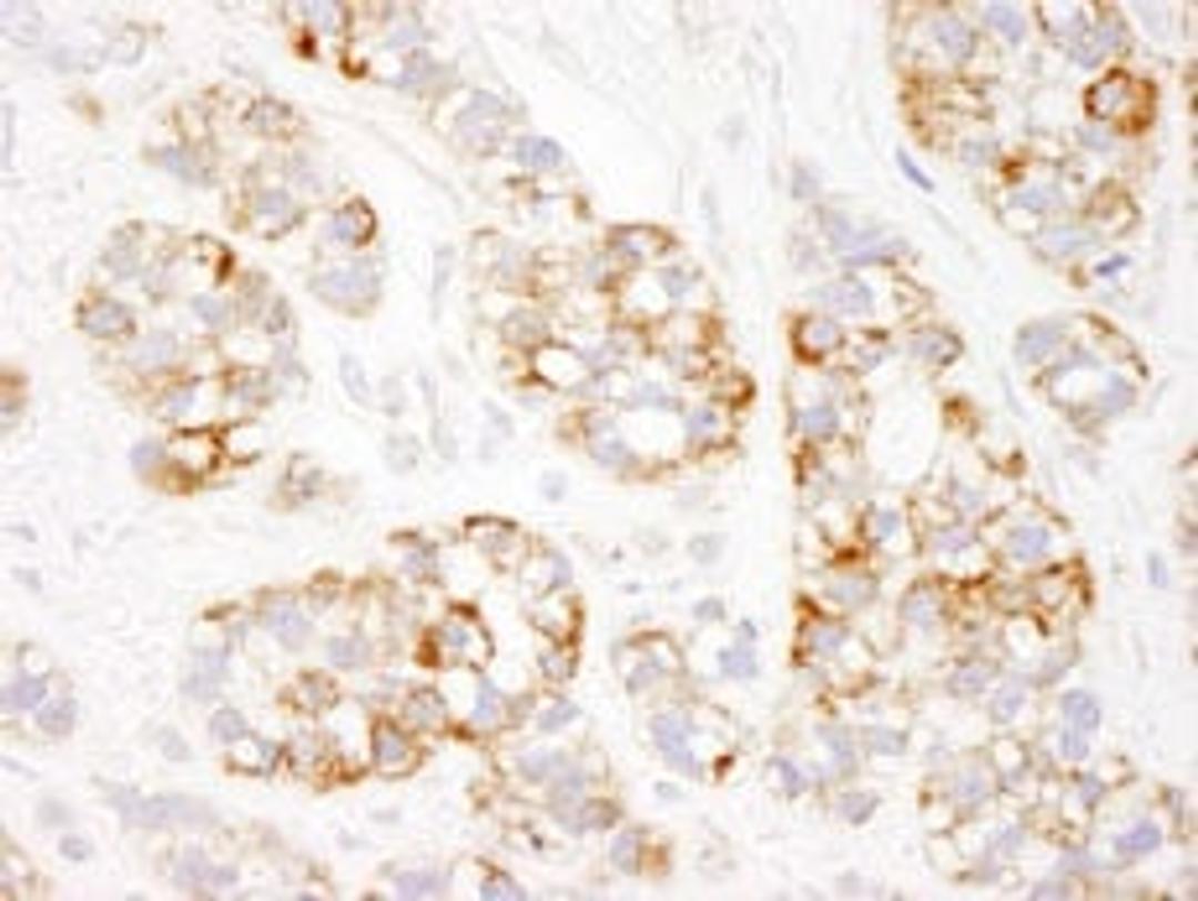 Detection of human Prohibitin by immunohistochemistry.