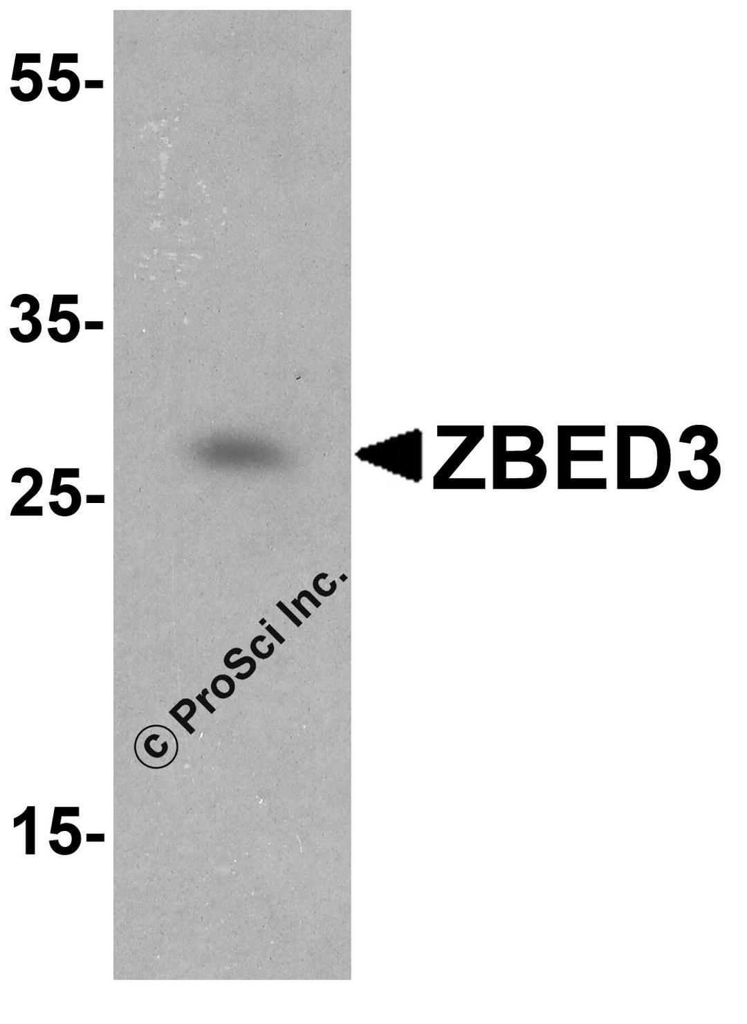 Western blot analysis of ZBED3 in Jurkat cell lysate with ZBED3 antibody at 1 μg/ml.