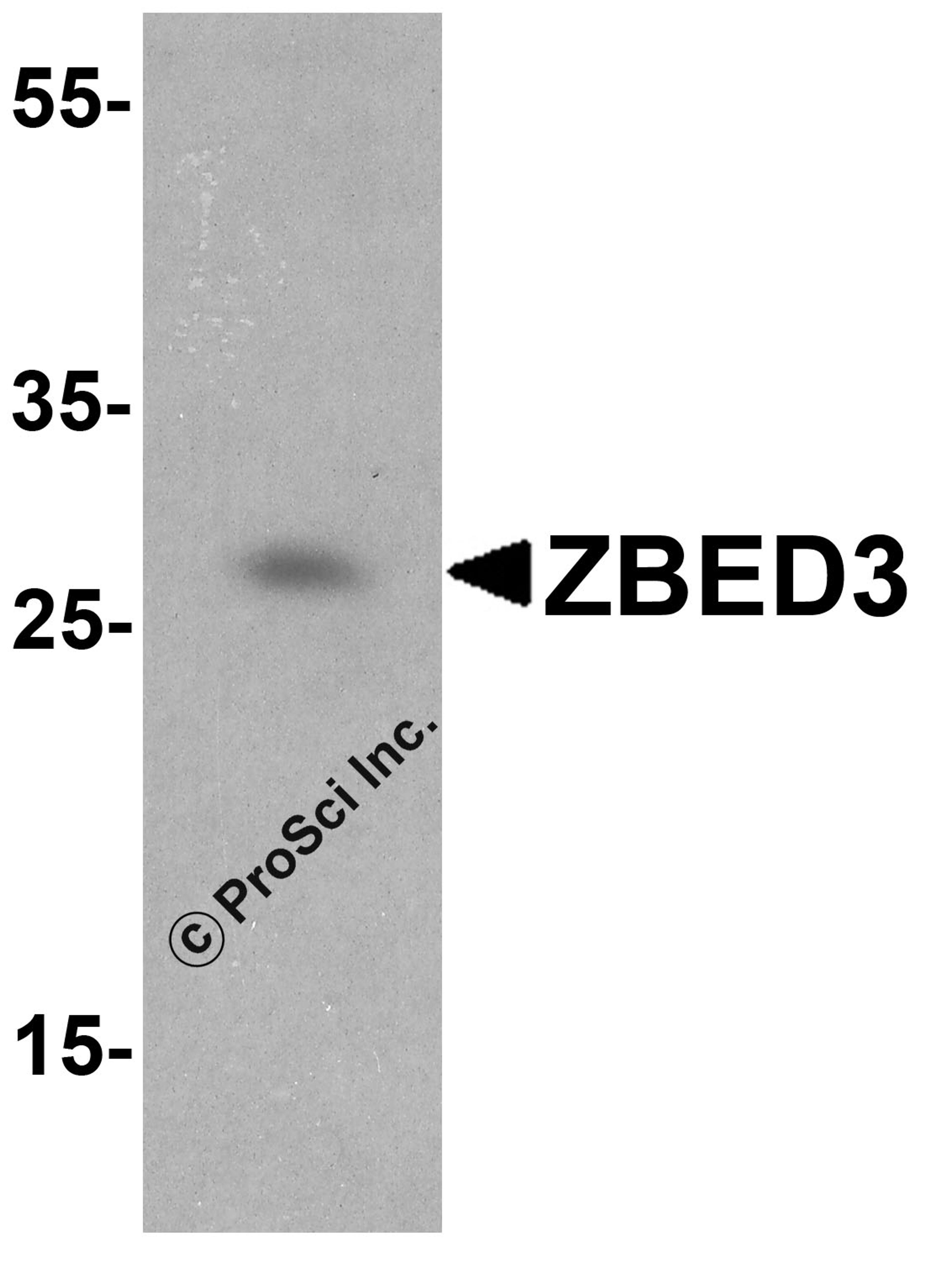 Western blot analysis of ZBED3 in Jurkat cell lysate with ZBED3 antibody at 1 μg/ml.