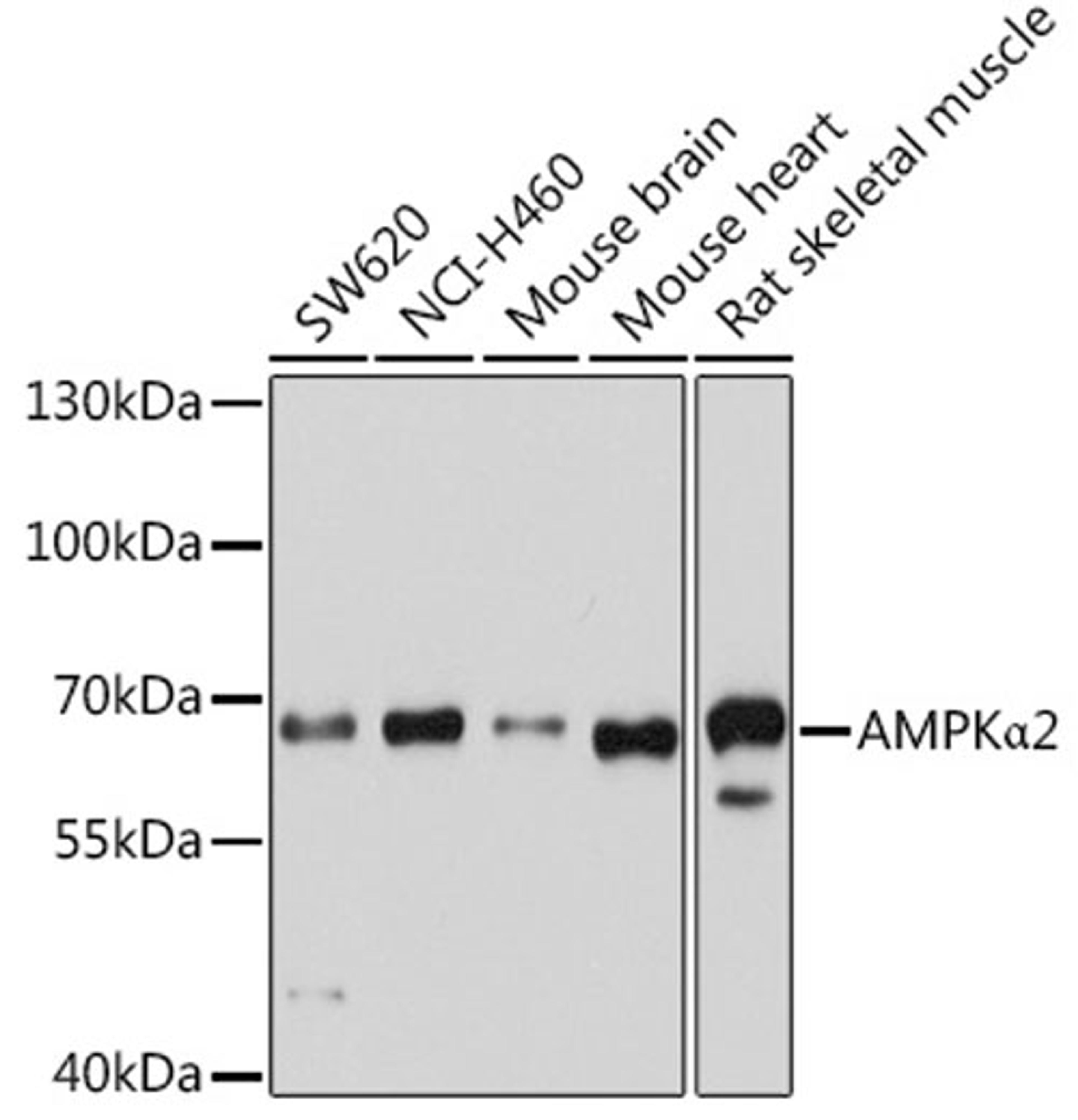 Western blot - AMPKa2 antibody (A7339)