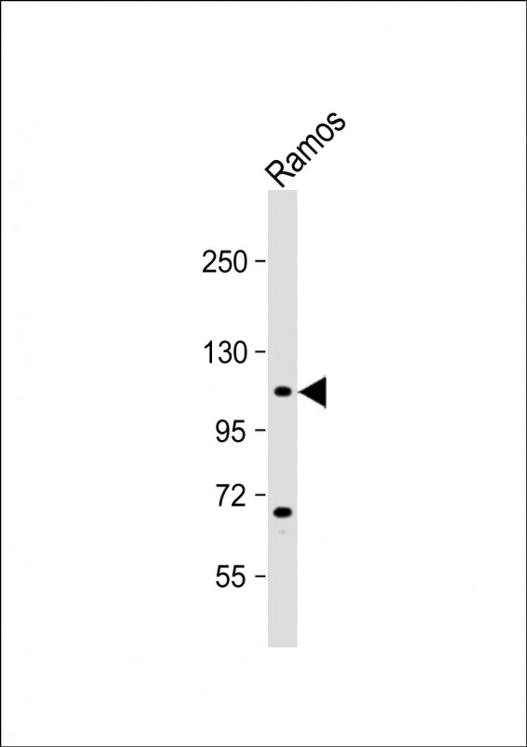 Western Blot at 1:4000 dilution + Ramos whole cell lysate Lysates/proteins at 20 ug per lane.