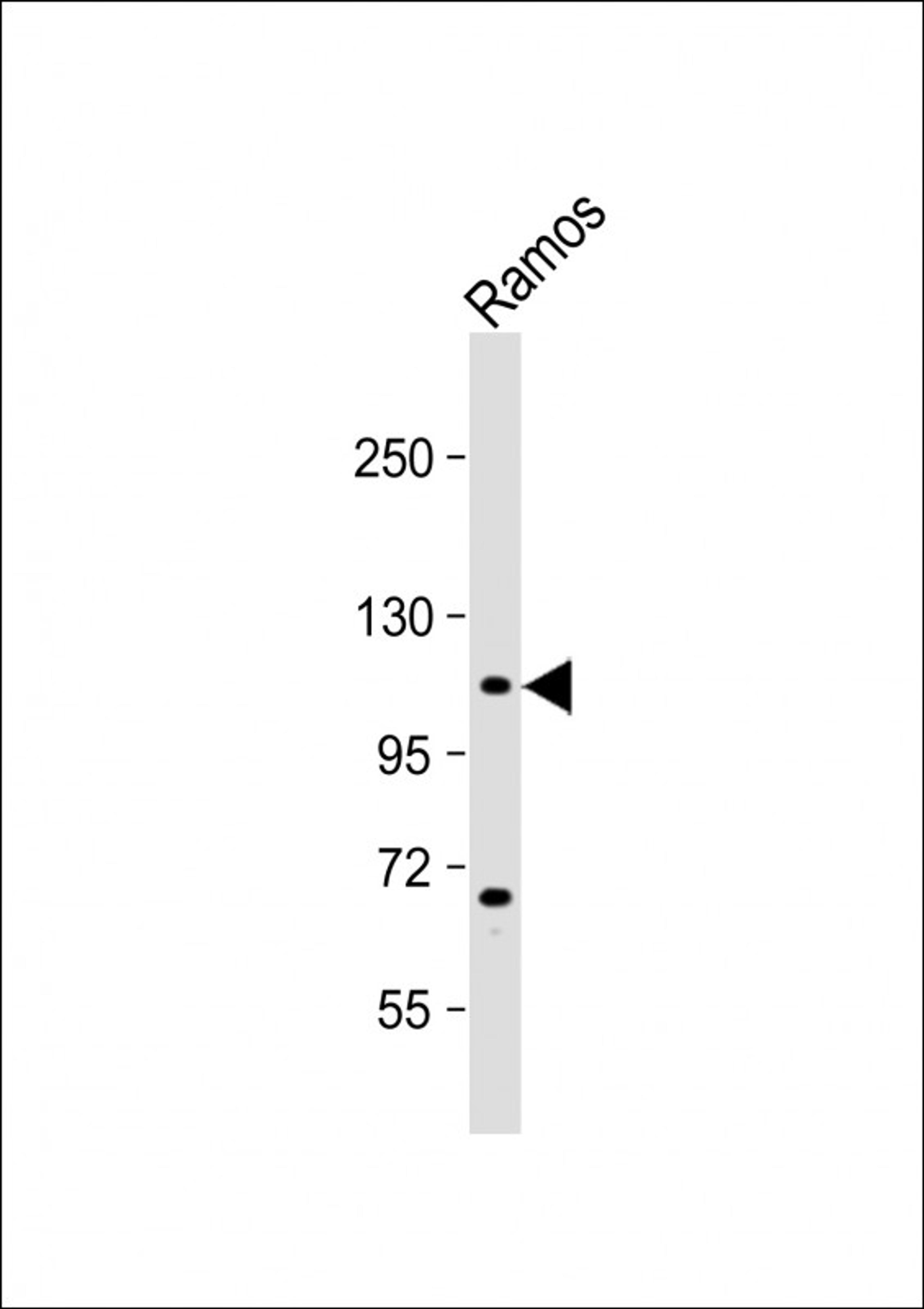 Western Blot at 1:4000 dilution + Ramos whole cell lysate Lysates/proteins at 20 ug per lane.