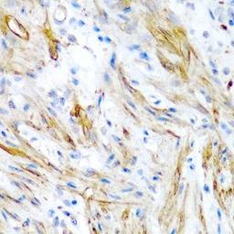 Immunohistochemical staining of human colon tissue using LMOD1 antibody (dilution of 1:200)