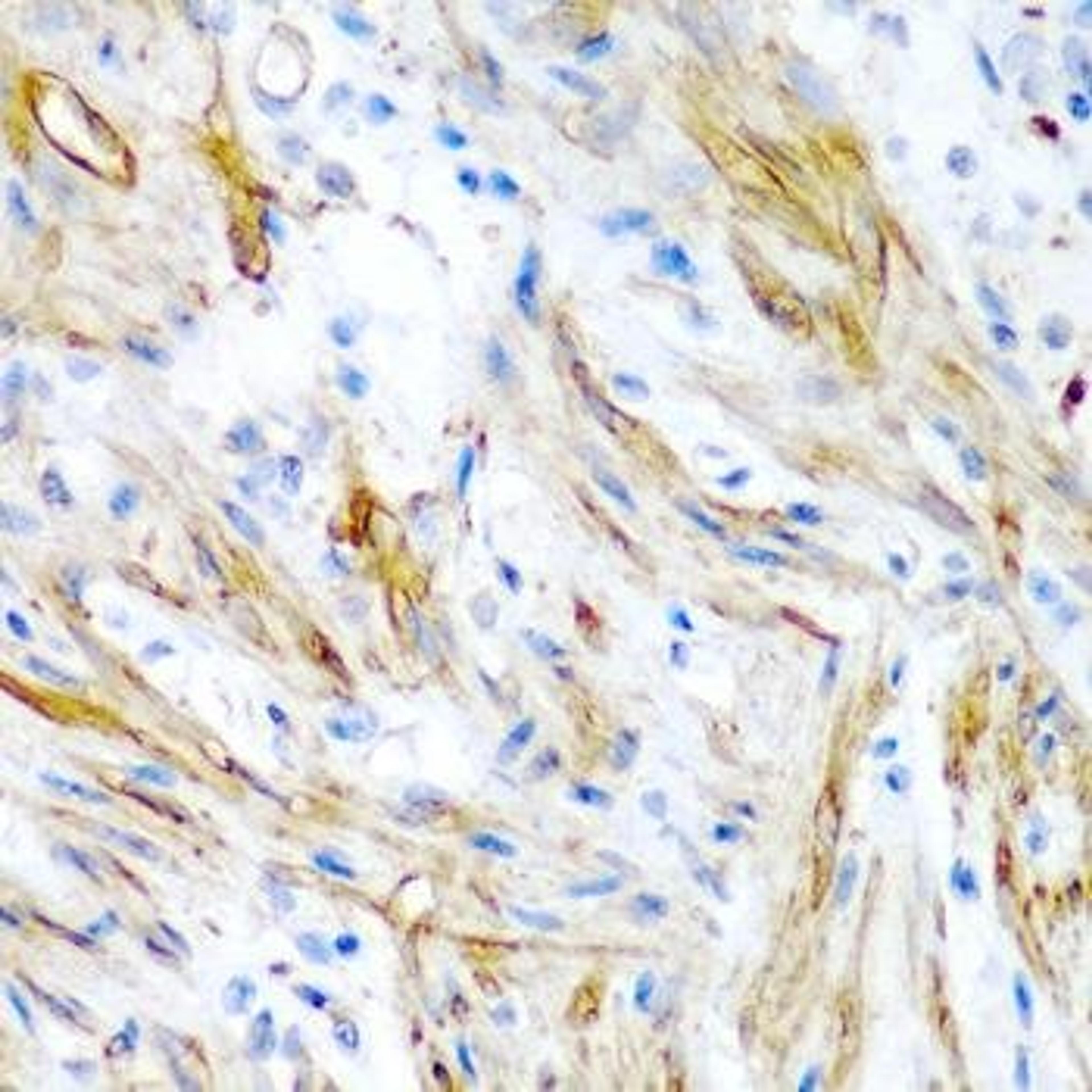 Immunohistochemical staining of human colon tissue using LMOD1 antibody (dilution of 1:200)