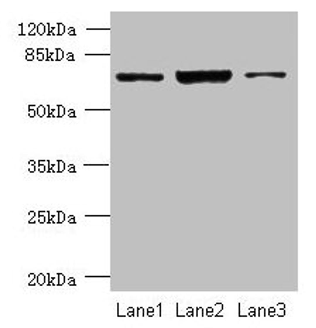 Western blot. All lanes: CCDC116 antibody at 1.5µg/ml. Lane 1: SH-SY5Y whole cell lysate. Lane 2: Hela whole cell lysate. Lane 3: HCT116 whole cell lysate. Secondary. Goat polyclonal to rabbit IgG at 1/10000 dilution. Predicted band size: 68, 57, 58 kDa. Observed band size: 68 kDa