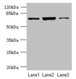 Western blot. All lanes: CCDC116 antibody at 1.5µg/ml. Lane 1: SH-SY5Y whole cell lysate. Lane 2: Hela whole cell lysate. Lane 3: HCT116 whole cell lysate. Secondary. Goat polyclonal to rabbit IgG at 1/10000 dilution. Predicted band size: 68, 57, 58 kDa. Observed band size: 68 kDa