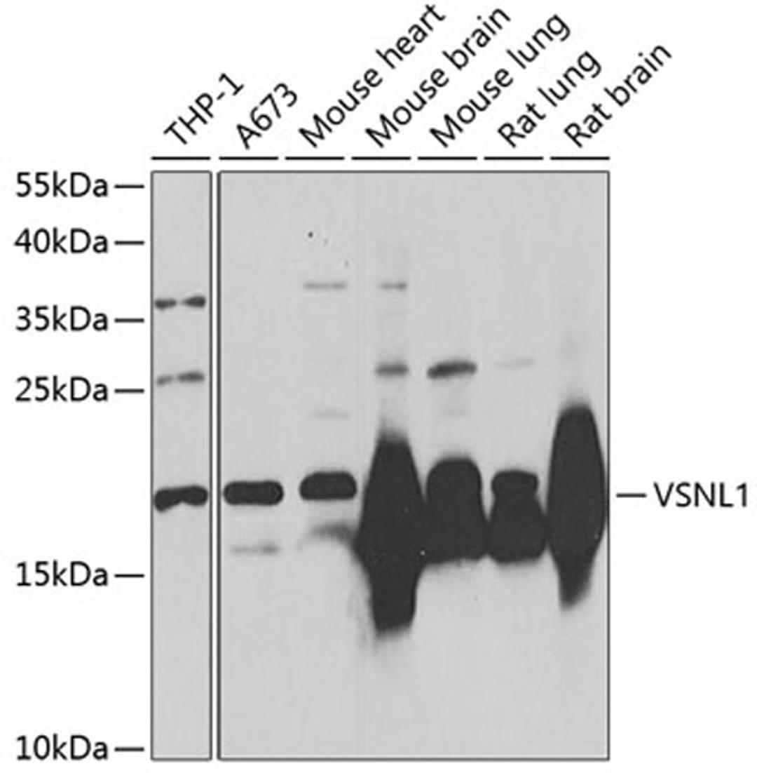 Western blot - VSNL1 Antibody (A2797)