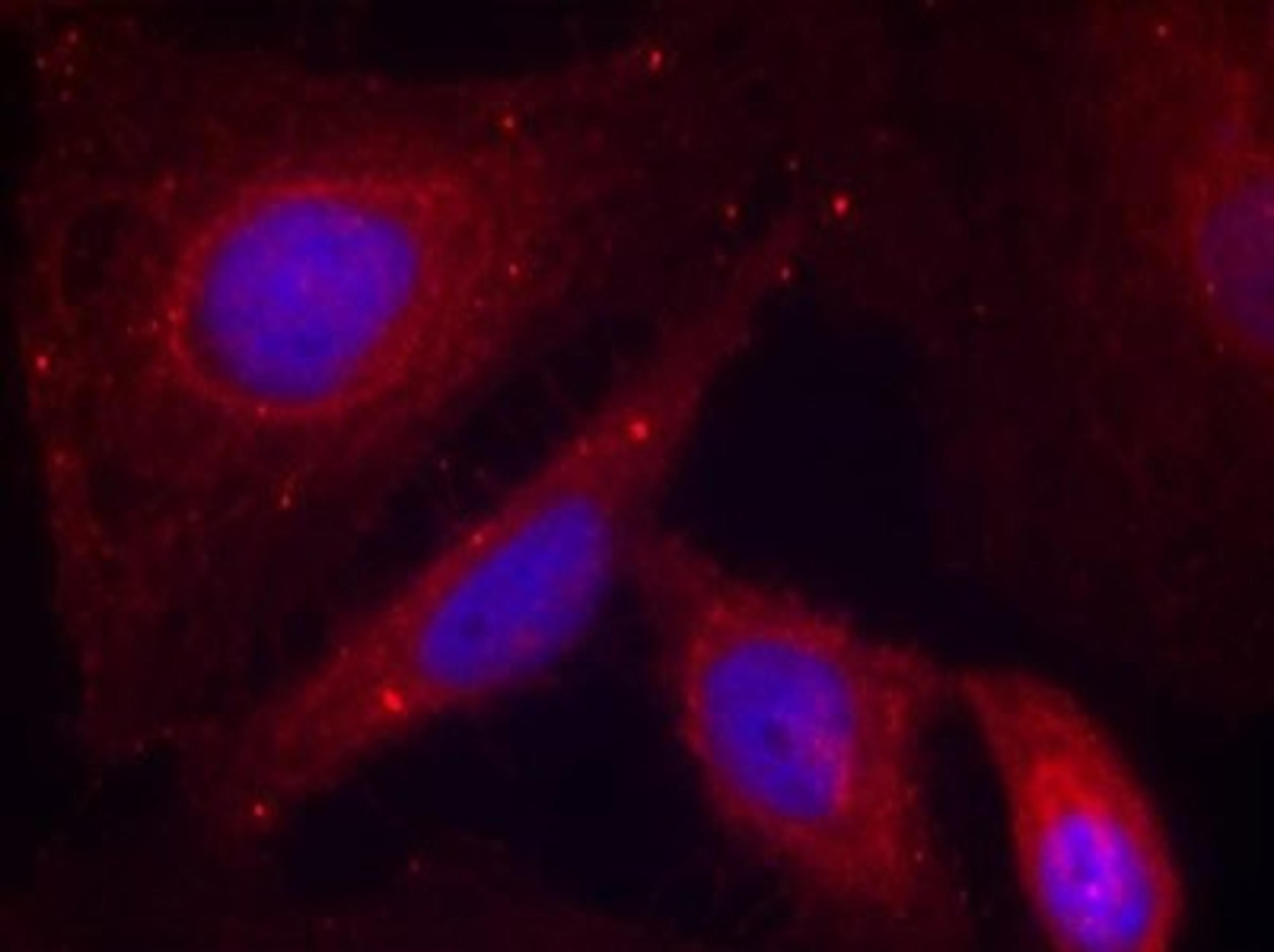 Immunocytochemistry/Immunofluorescence: PAK1 [p Thr212] Antibody [NB100-82129] - Staining of methanol-fixed Hela cells using PAK1(Phospho-Thr212) antibody