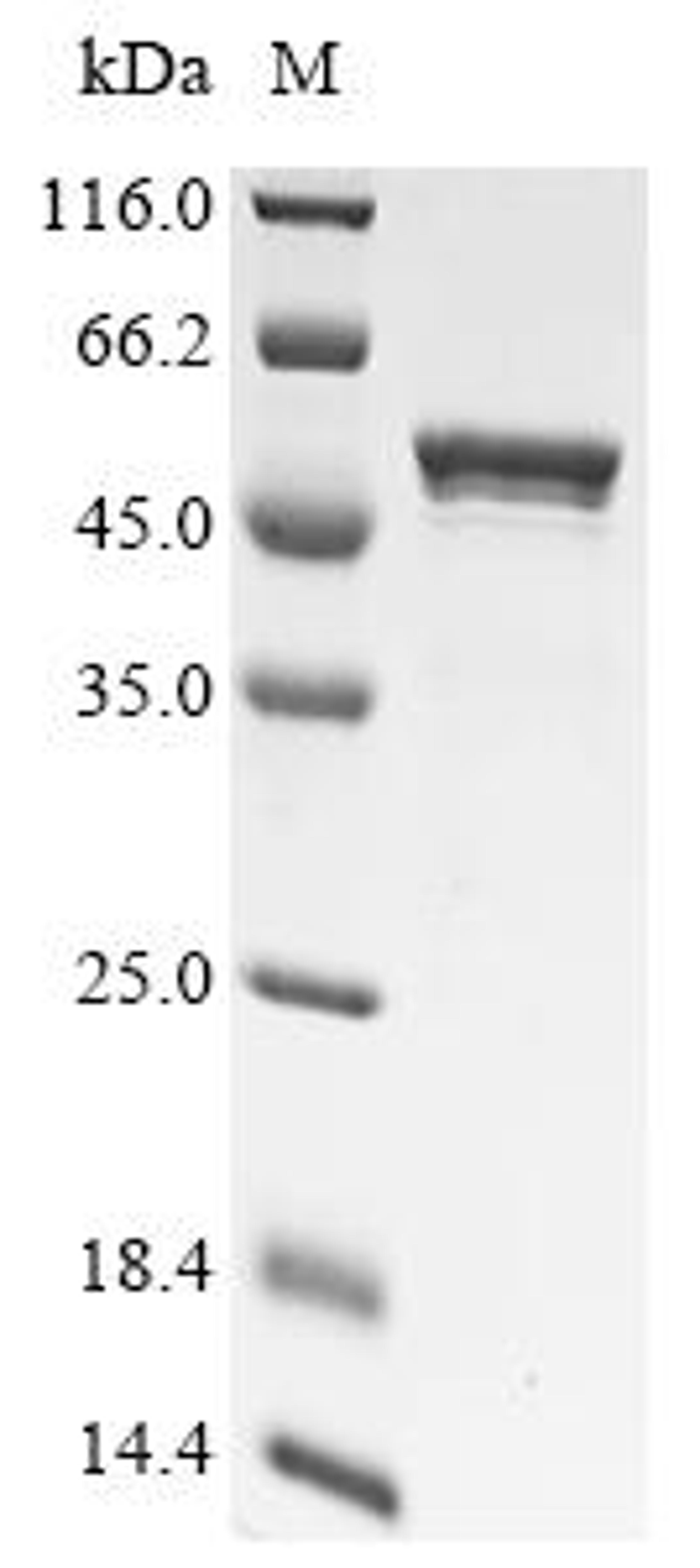 (Tris-Glycine gel) Discontinuous SDS-PAGE (reduced) with 5% enrichment gel and 15% separation gel.