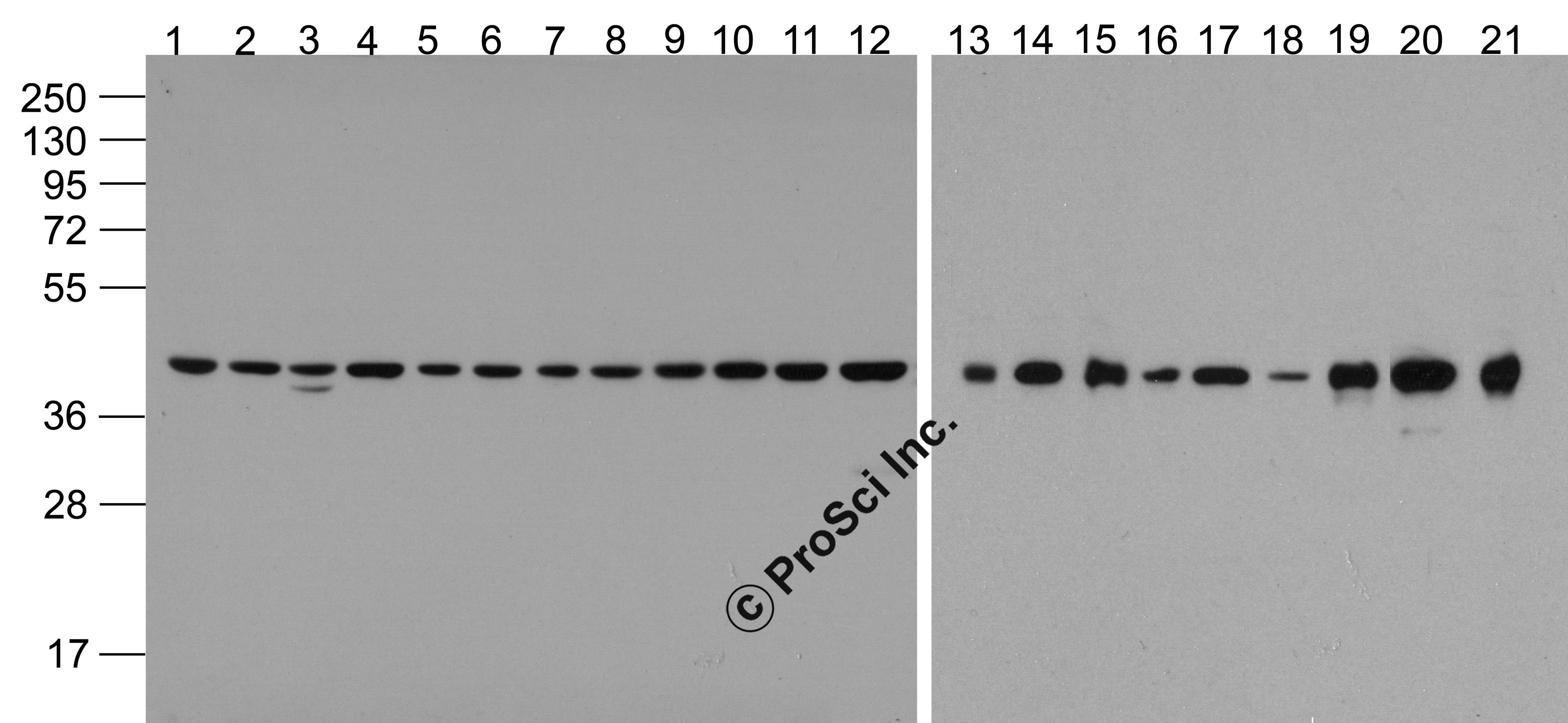 Western blot analysis of beta-Actin (HRP) in 293, A431, A549, Daudi, HeLa, HepG2, Jurkat, K562, MOLT4, 3T3, Raji, THP-1, mouse brain, rat brain, rabbit brain, mouse lung, rat lung, rat liver, rabbit spleen, chicken small intestine, and drosophila lysate w