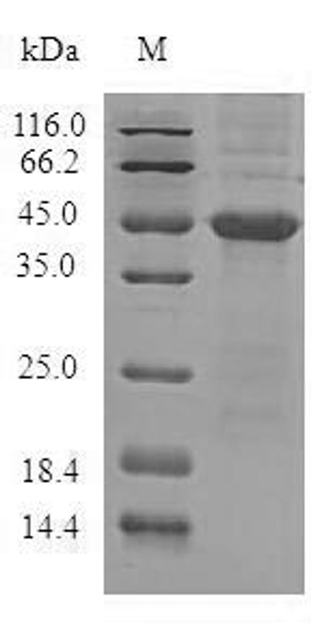 (Tris-Glycine gel) Discontinuous SDS-PAGE (reduced) with 5% enrichment gel and 15% separation gel.