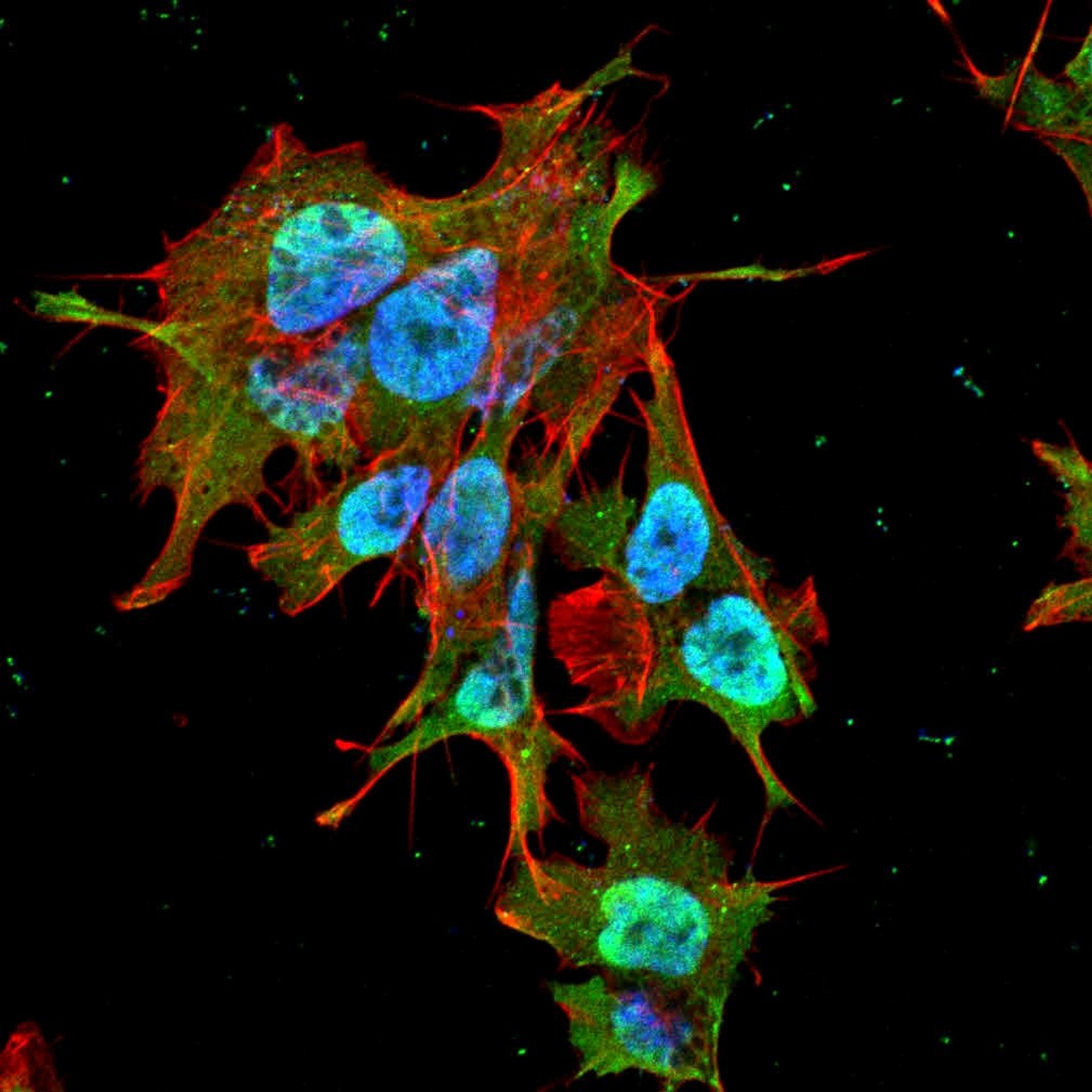 Immunofluorescence analysis of neuroblastoma cell line sk-n-be using REEP1 antibody