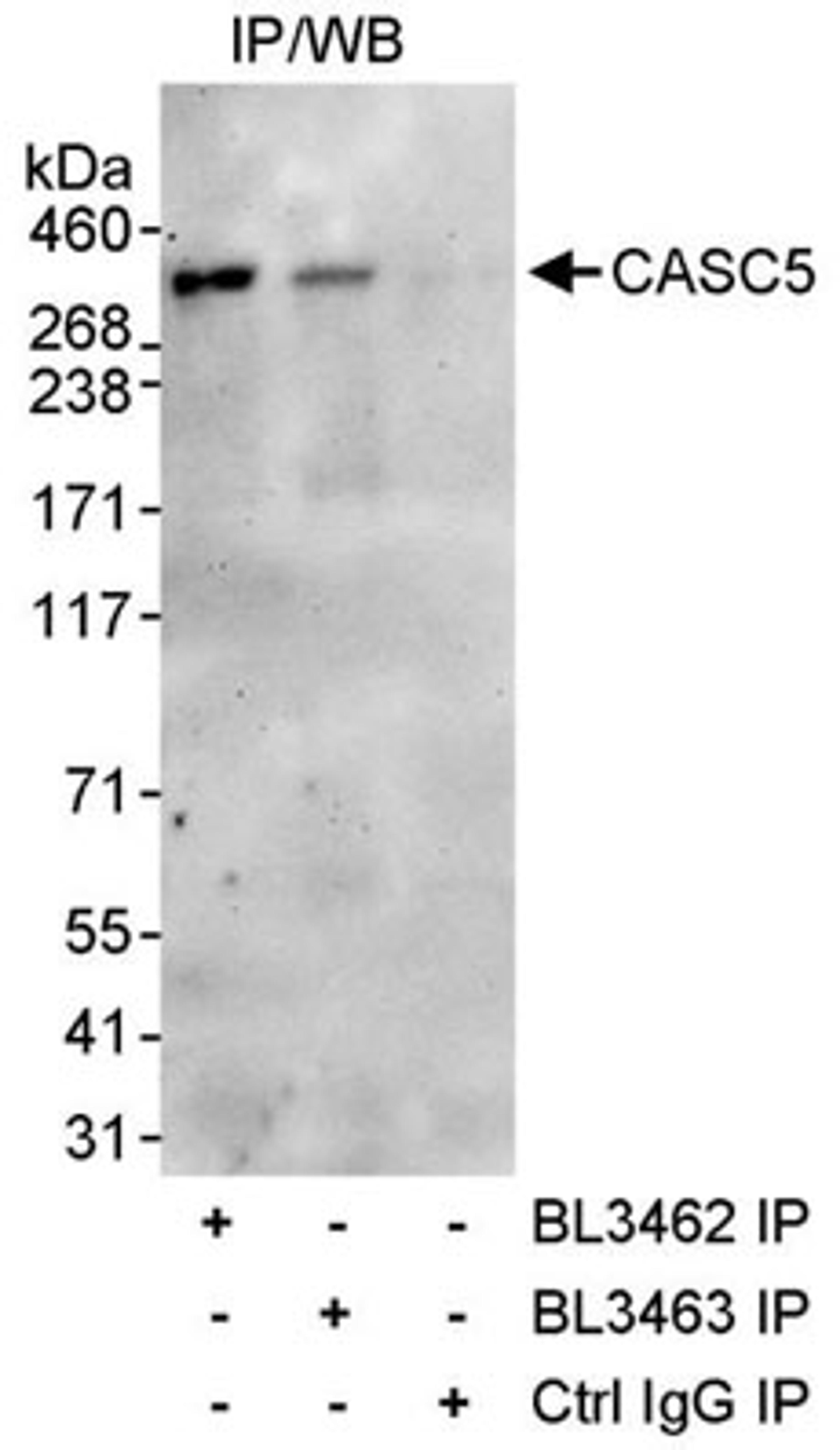 Detection of human CASC5 by western blot of immunoprecipitates.