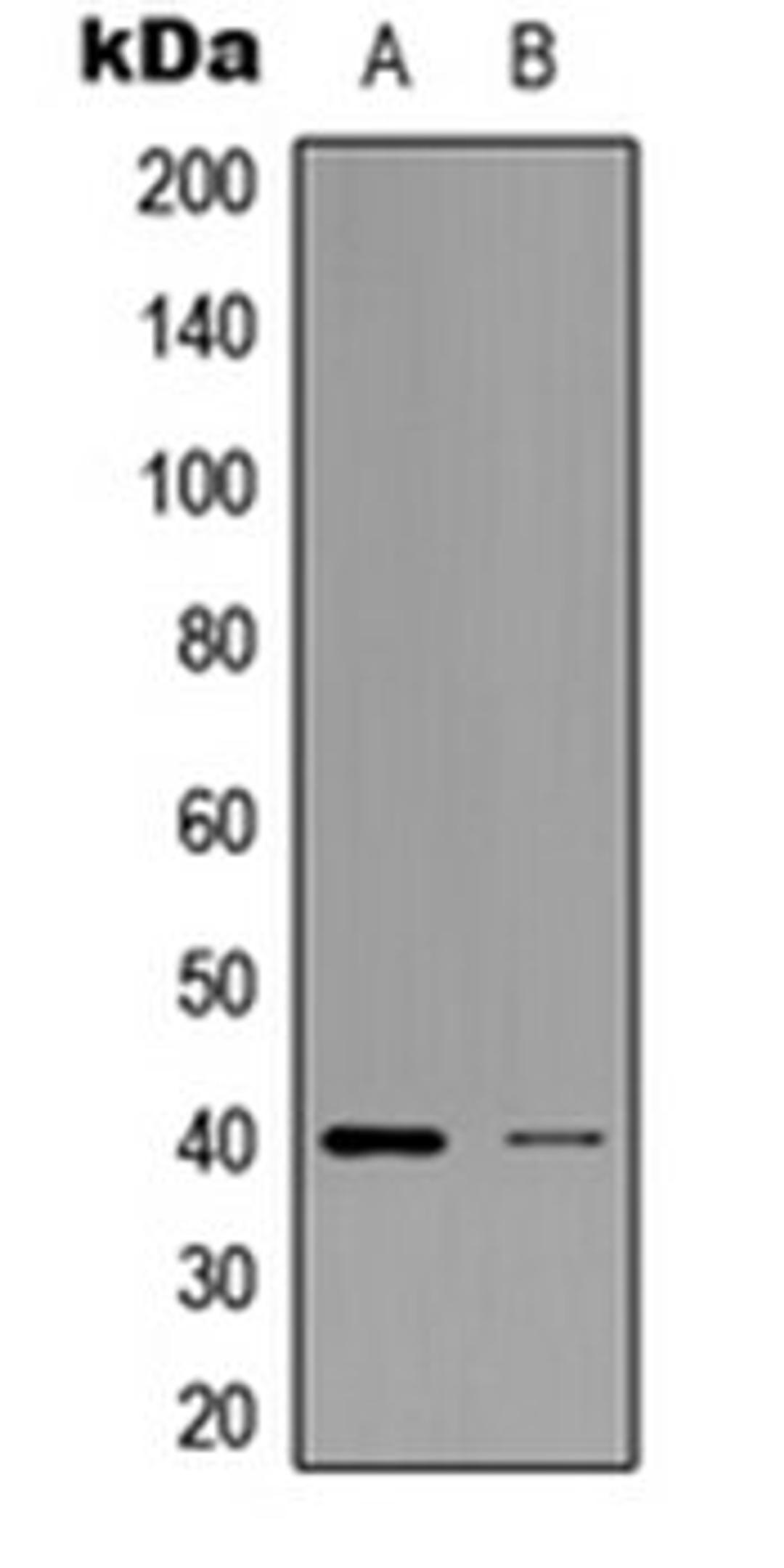 Western blot analysis of K562 (Lane 1), HEK293T (Lane 2) whole cell lysates using ZNF134 antibody