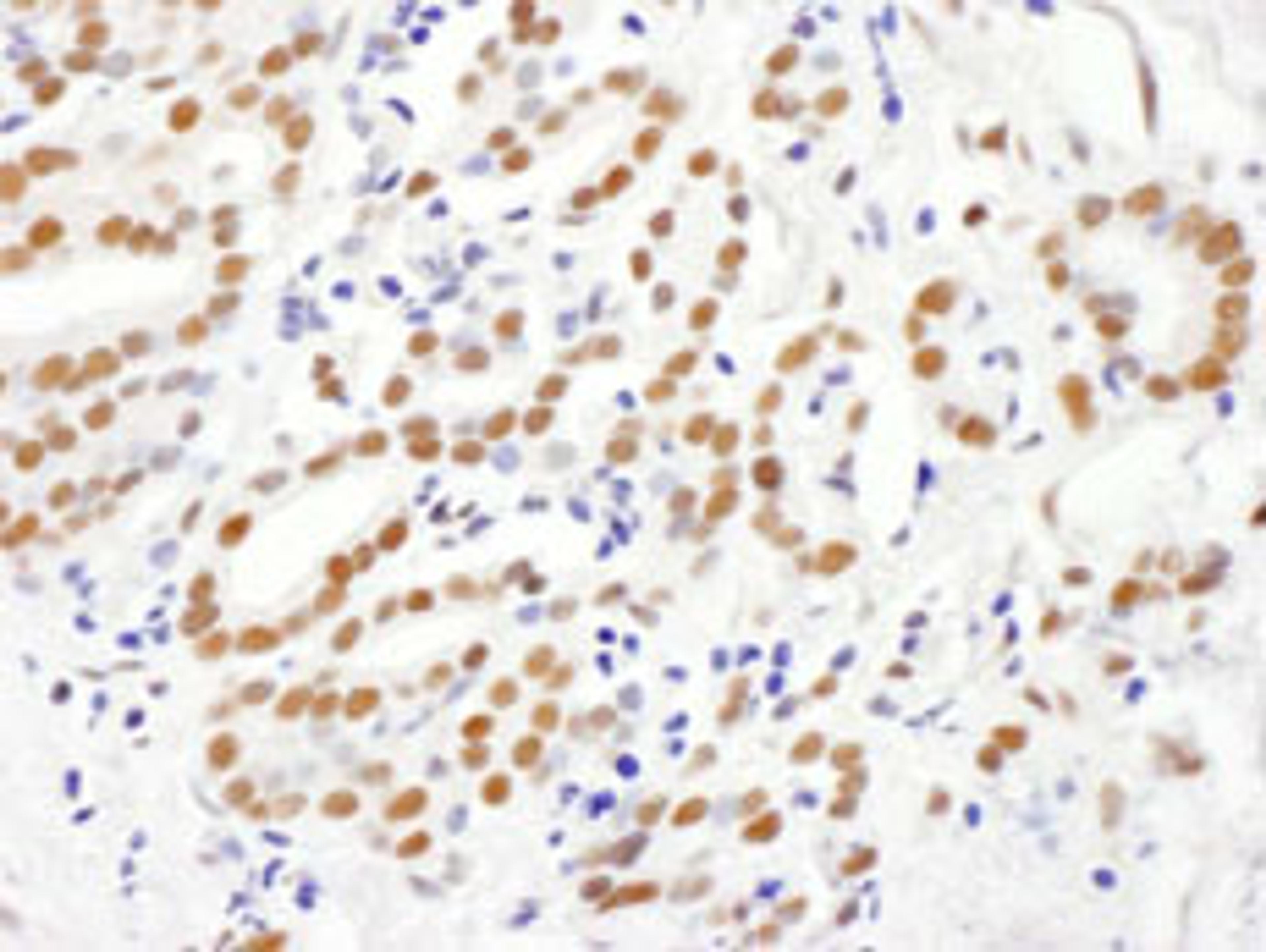 Detection of human RING1 by immunohistochemistry.