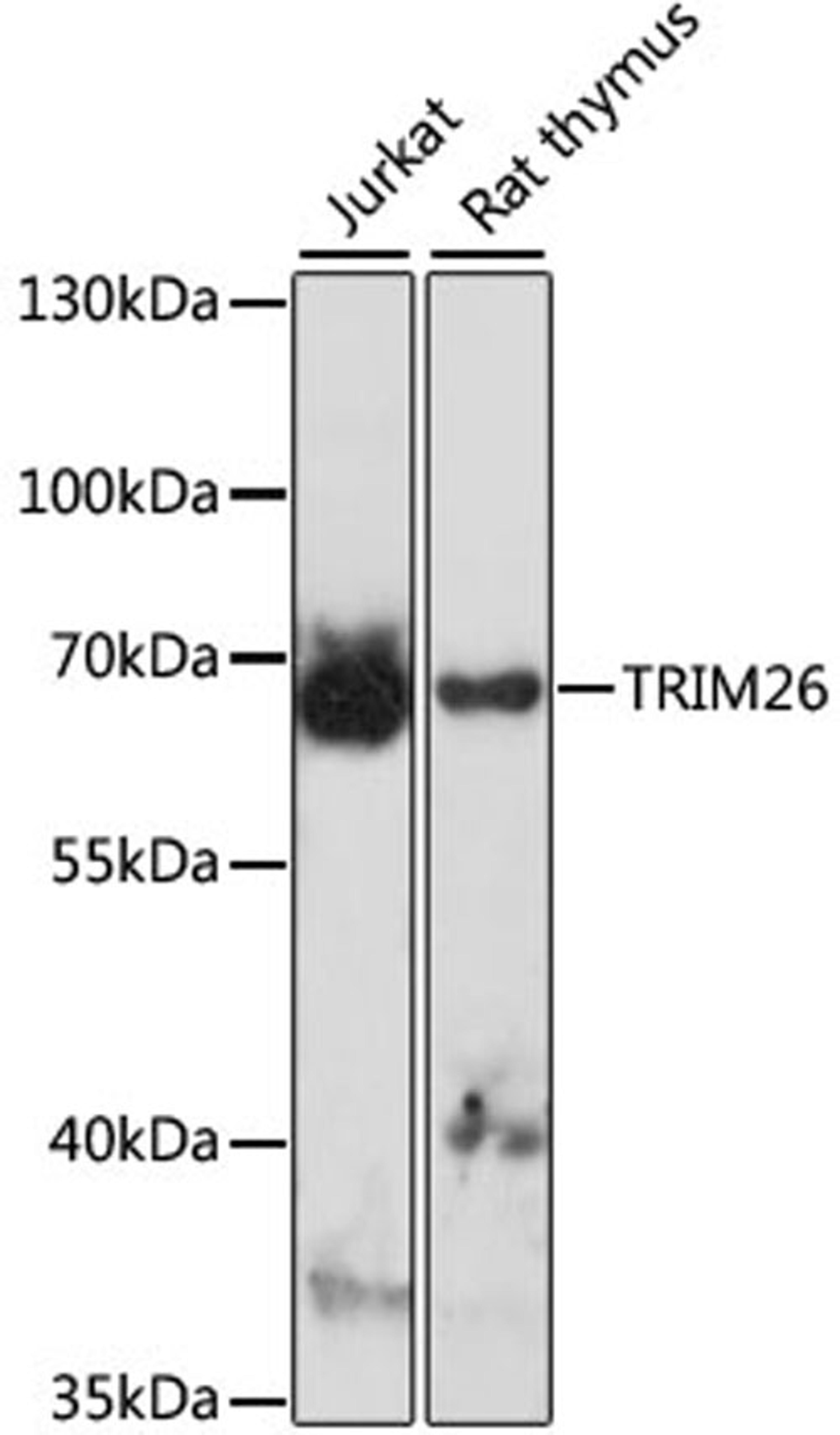 Western blot - TRIM26 antibody (A15332)