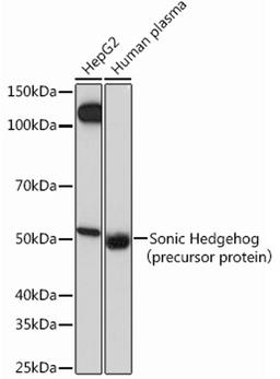 Western blot - Sonic Hedgehog Rabbit mAb (A12695)