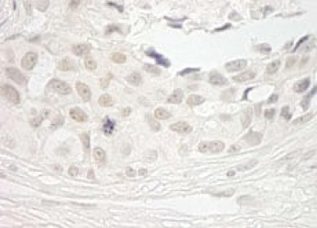 Detection of human PPP1CB by immunohistochemistry.