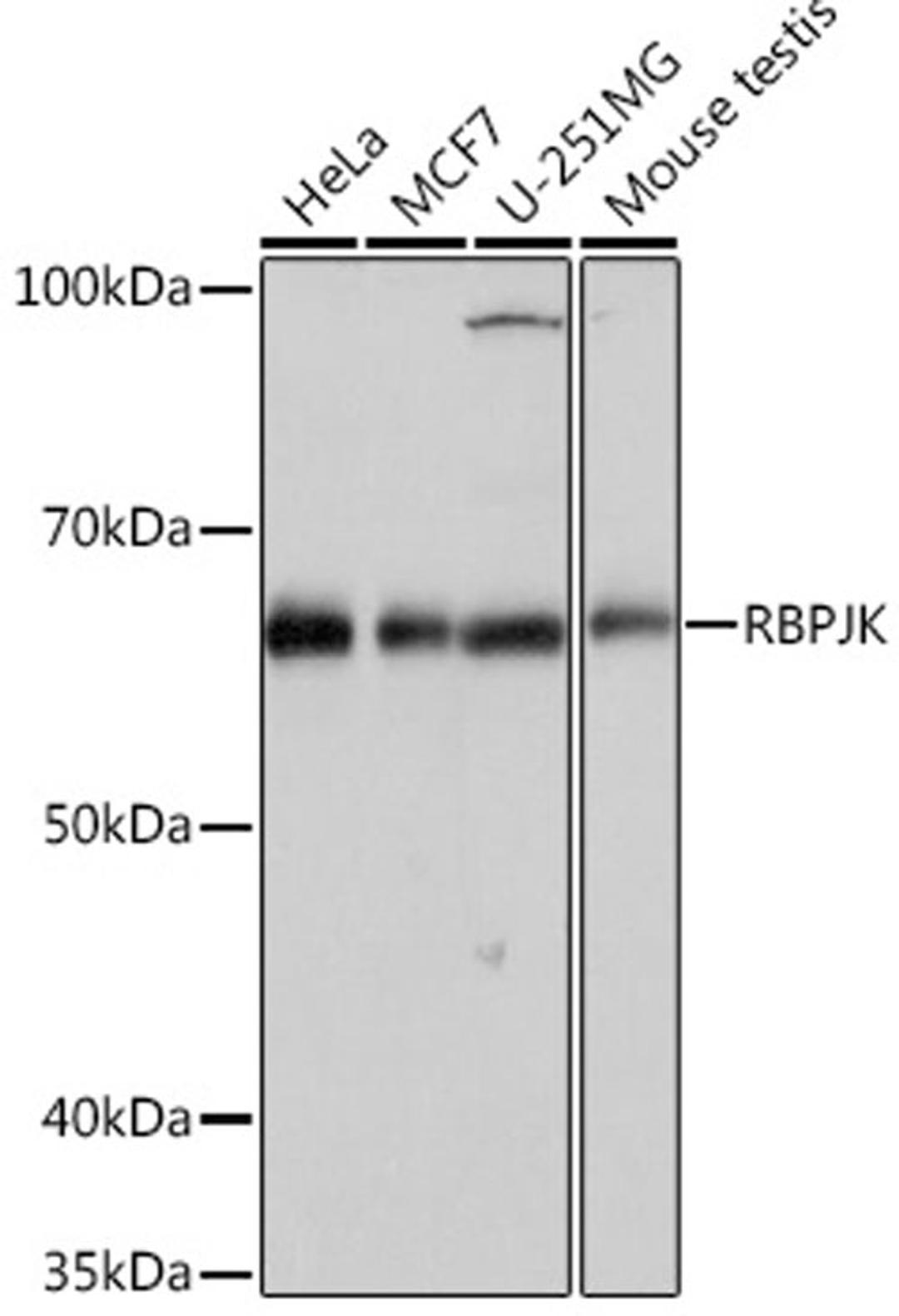 Western blot - RBPJK Rabbit mAb (A4081)