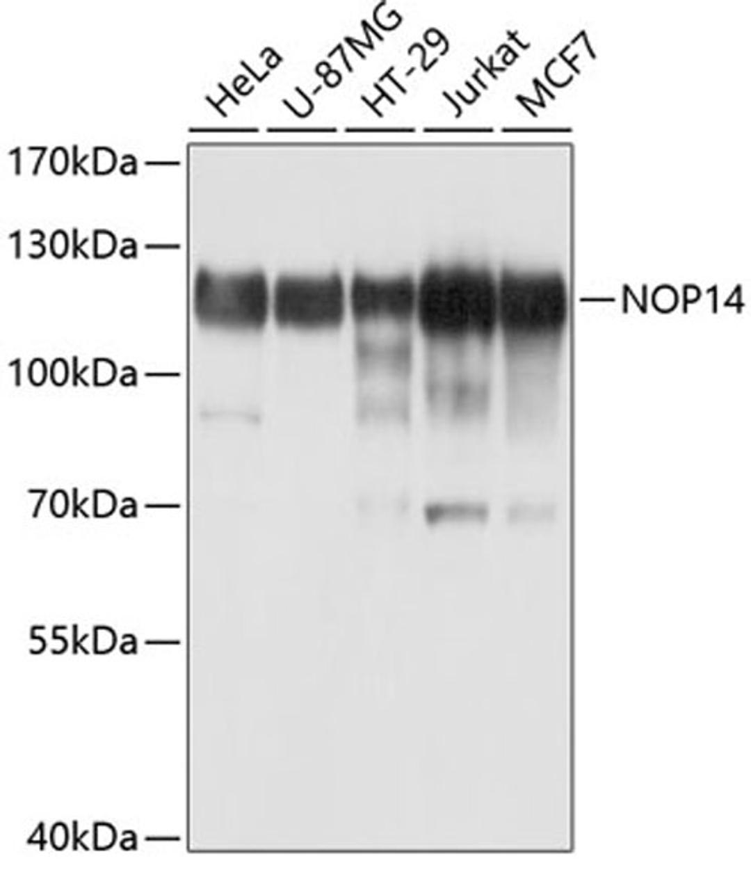 Western blot - NOP14 antibody (A10361)