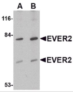 Western blot analysis of EVER2 in Jurkat cell lysate with EVER2 antibody at (A) 1 and (B) 2 &#956;g/mL.