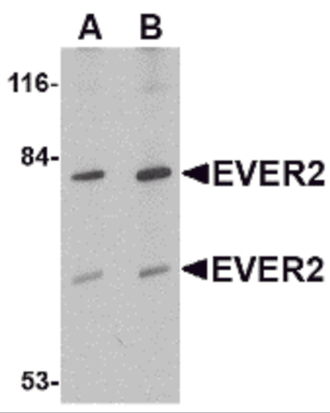 Western blot analysis of EVER2 in Jurkat cell lysate with EVER2 antibody at (A) 1 and (B) 2 μg/mL.