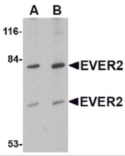 Western blot analysis of EVER2 in Jurkat cell lysate with EVER2 antibody at (A) 1 and (B) 2 μg/mL.