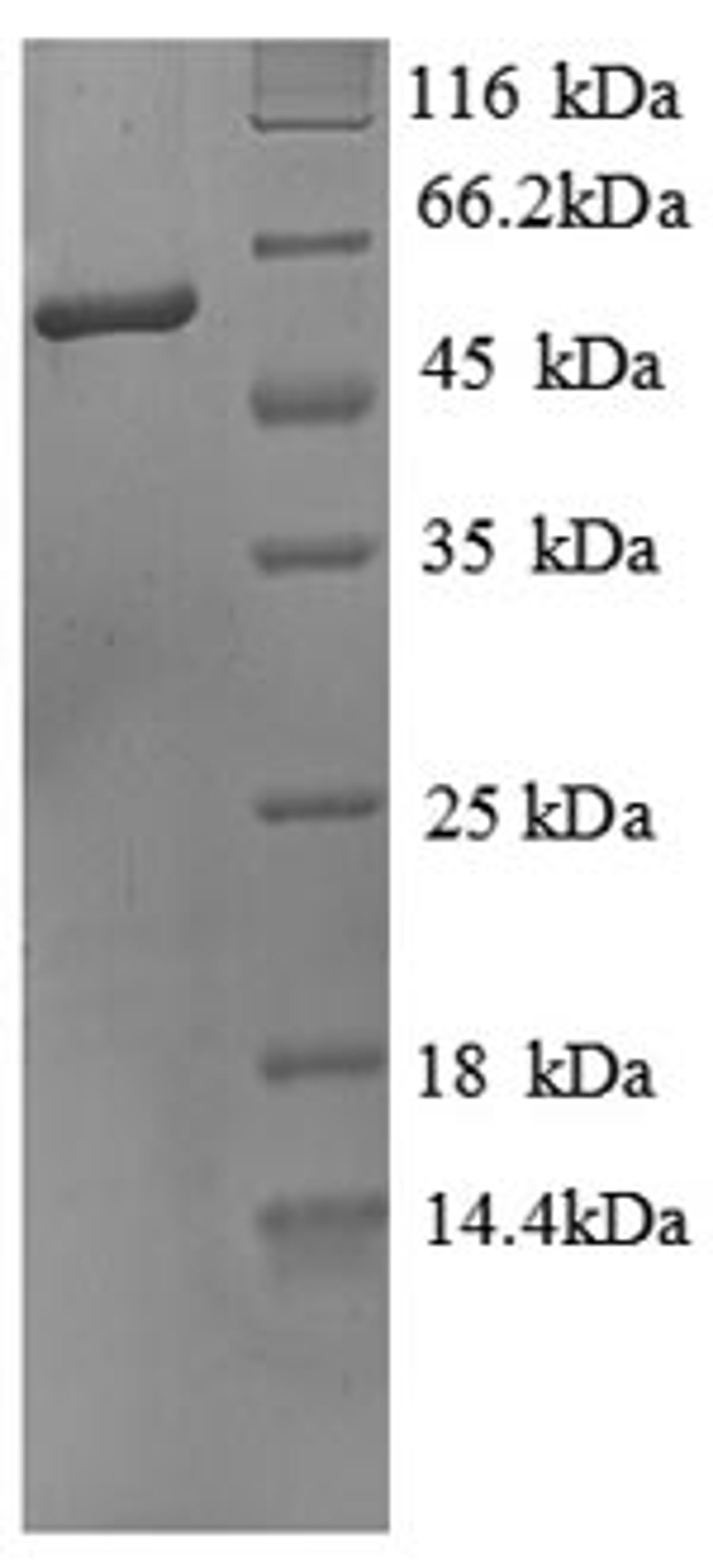 (Tris-Glycine gel) Discontinuous SDS-PAGE (reduced) with 5% enrichment gel and 15% separation gel.