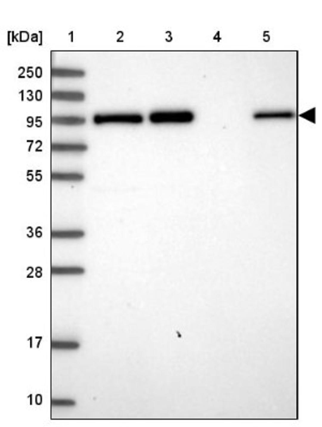 Western Blot: Golgin 97 Antibody [NBP2-38528] - Lane 1: Marker [kDa] 250, 130, 95, 72, 55, 36, 28, 17, 10<br/>Lane 2: RT-4<br/>Lane 3: U-251 MG<br/>Lane 4: Human Plasma<br/>Lane 5: Liver