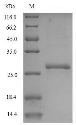 (Tris-Glycine gel) Discontinuous SDS-PAGE (reduced) with 5% enrichment gel and 15% separation gel.