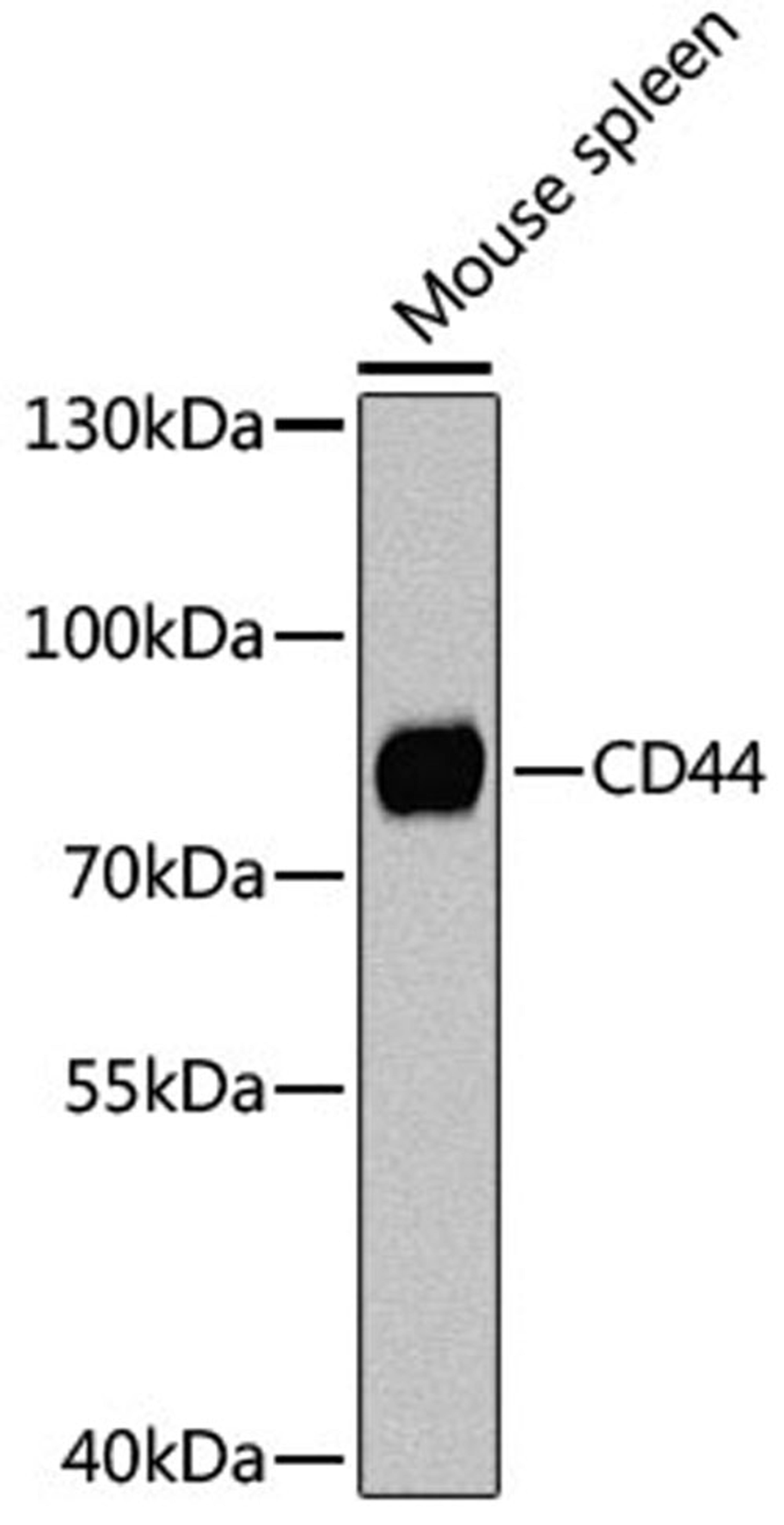 Western blot - CD44 Antibody (A12410)