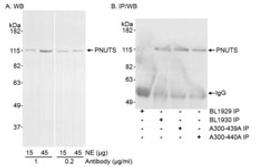 Detection of human PNUTS by western blot and immunoprecipitation.