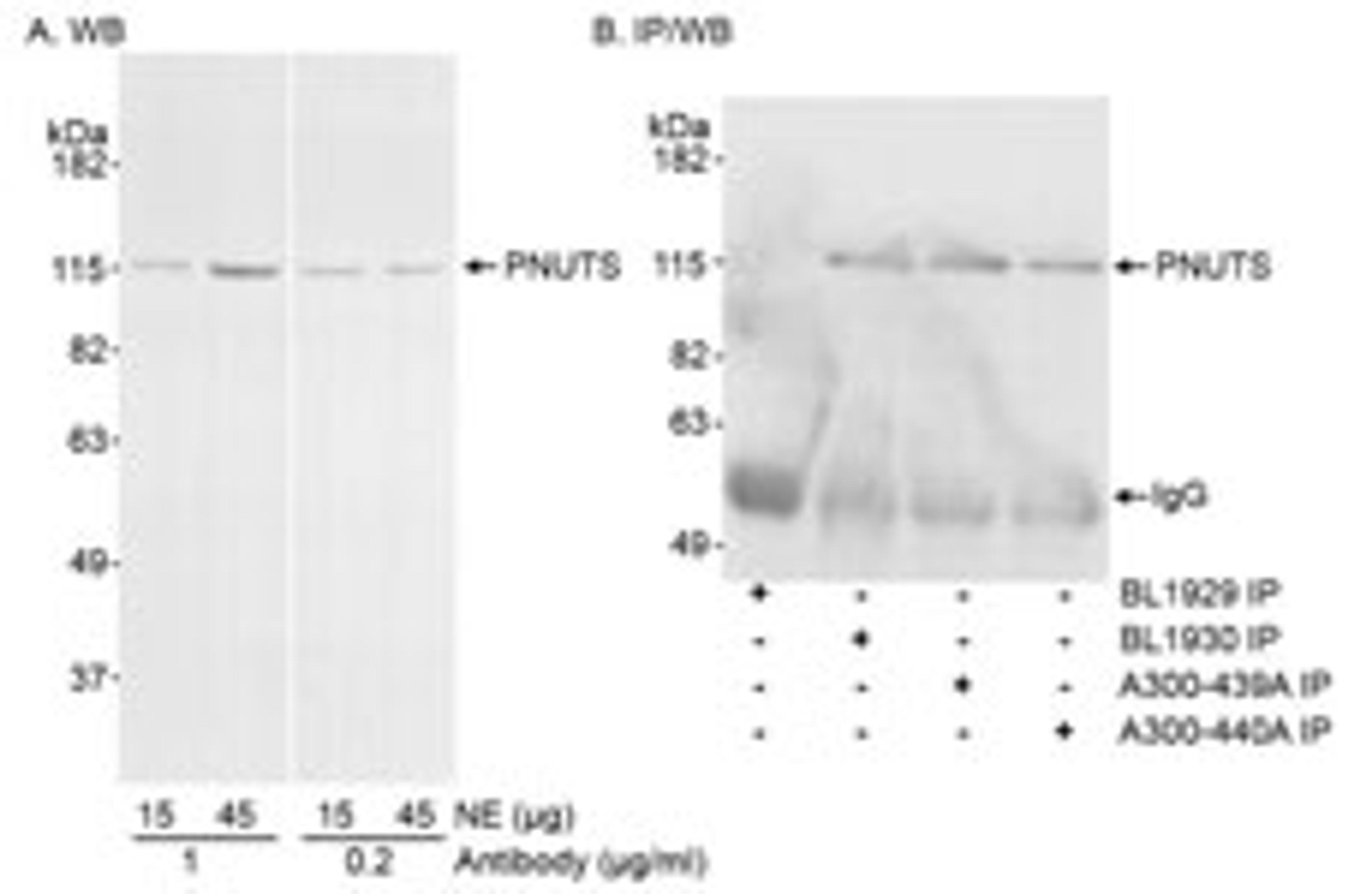 Detection of human PNUTS by western blot and immunoprecipitation.