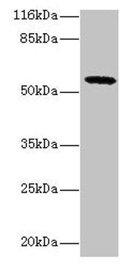 Western blot. All lanes: GDAP2 antibody at 2µg/ml + MCF-7 whole cell lysate. Secondary. Goat polyclonal to rabbit IgG at 1/10000 dilution. Predicted band size: 57 kDa. Observed band size: 57 kDa