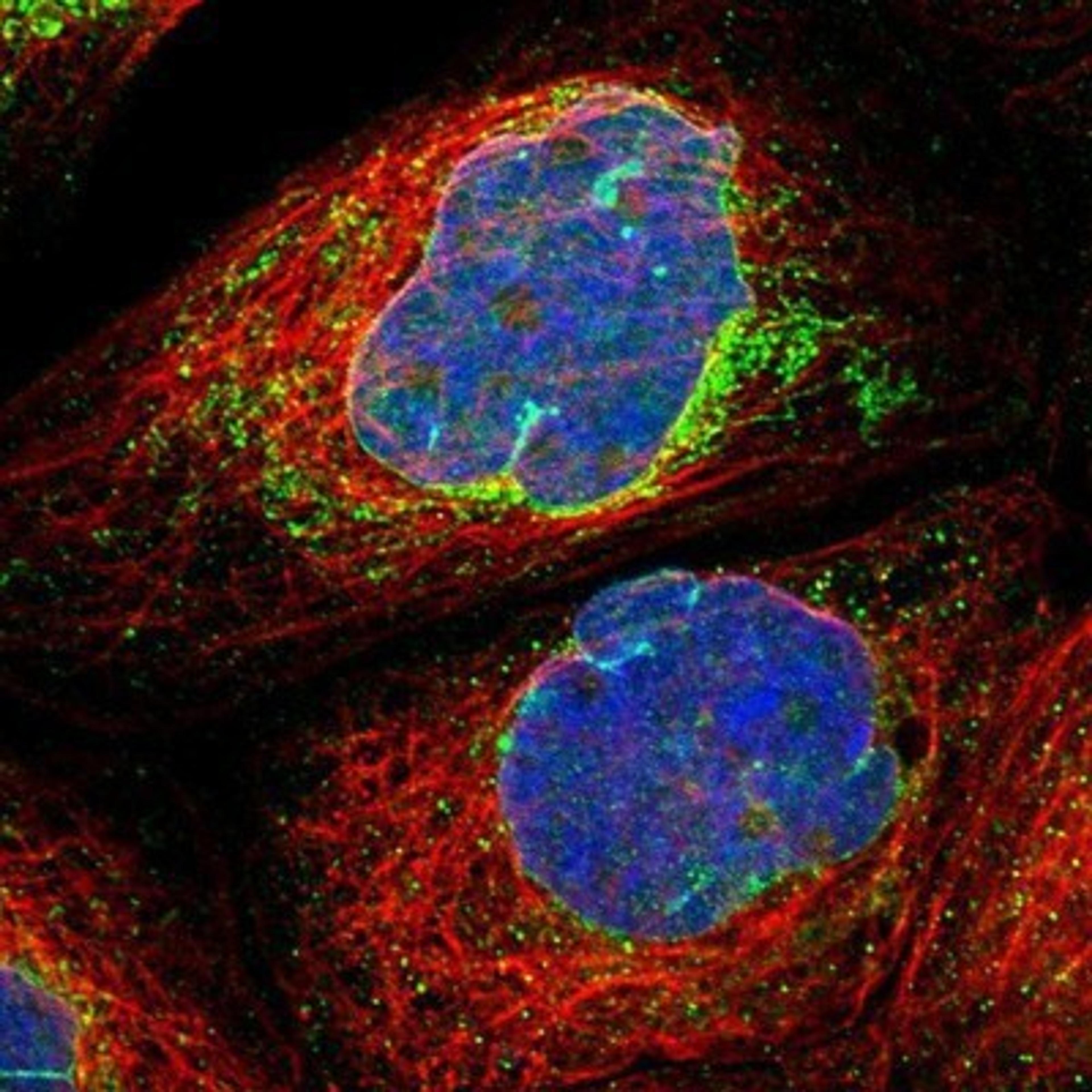 Immunocytochemistry/Immunofluorescence: MRPS23 Antibody [NBP1-84518] - Staining of human cell line A-431 shows positivity in nuclear membrane & mitochondria.