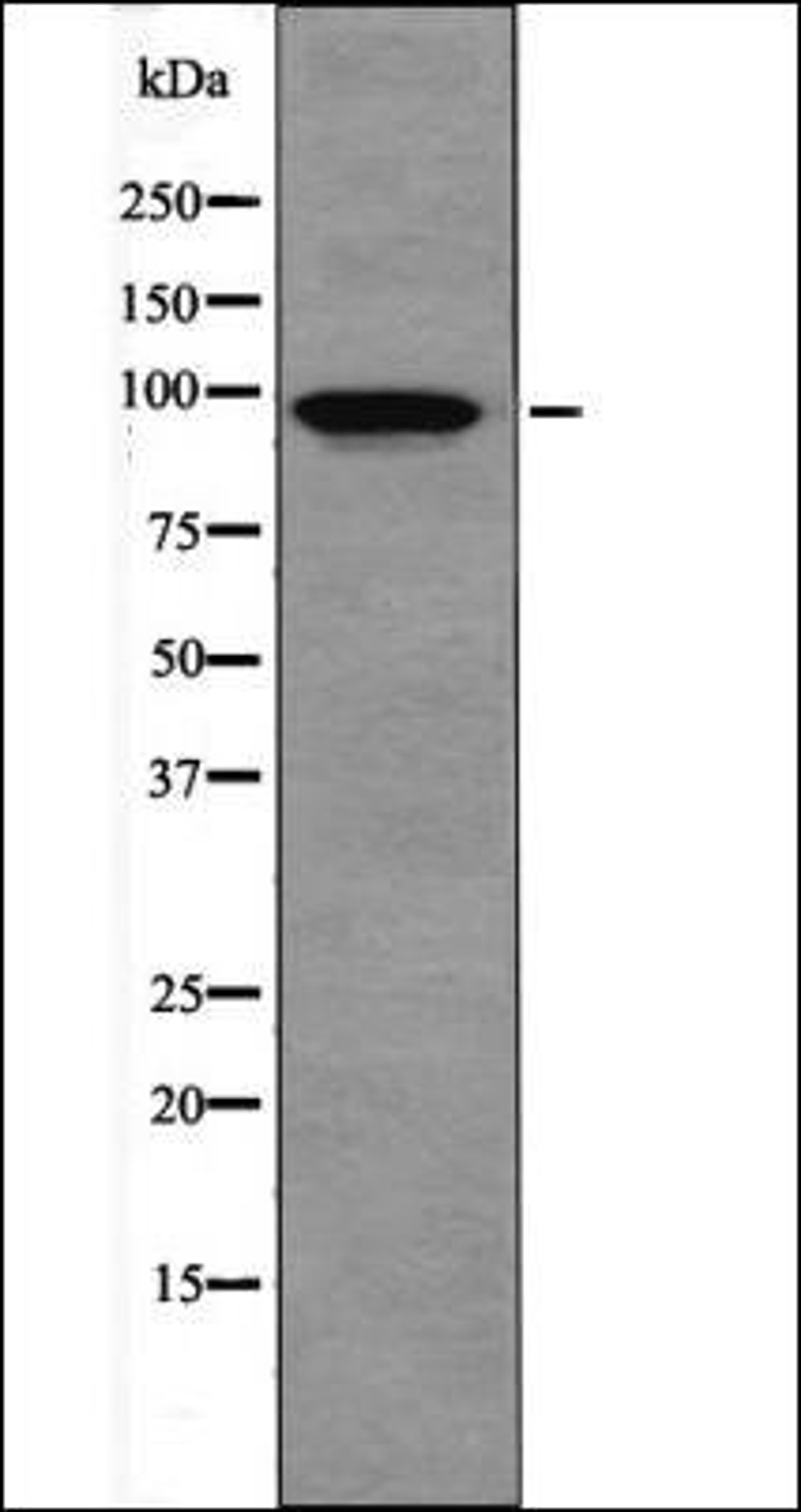 Western blot analysis of P Etoposide treated 293 whole cell lysates using IR -Phospho-Tyr999- antibody