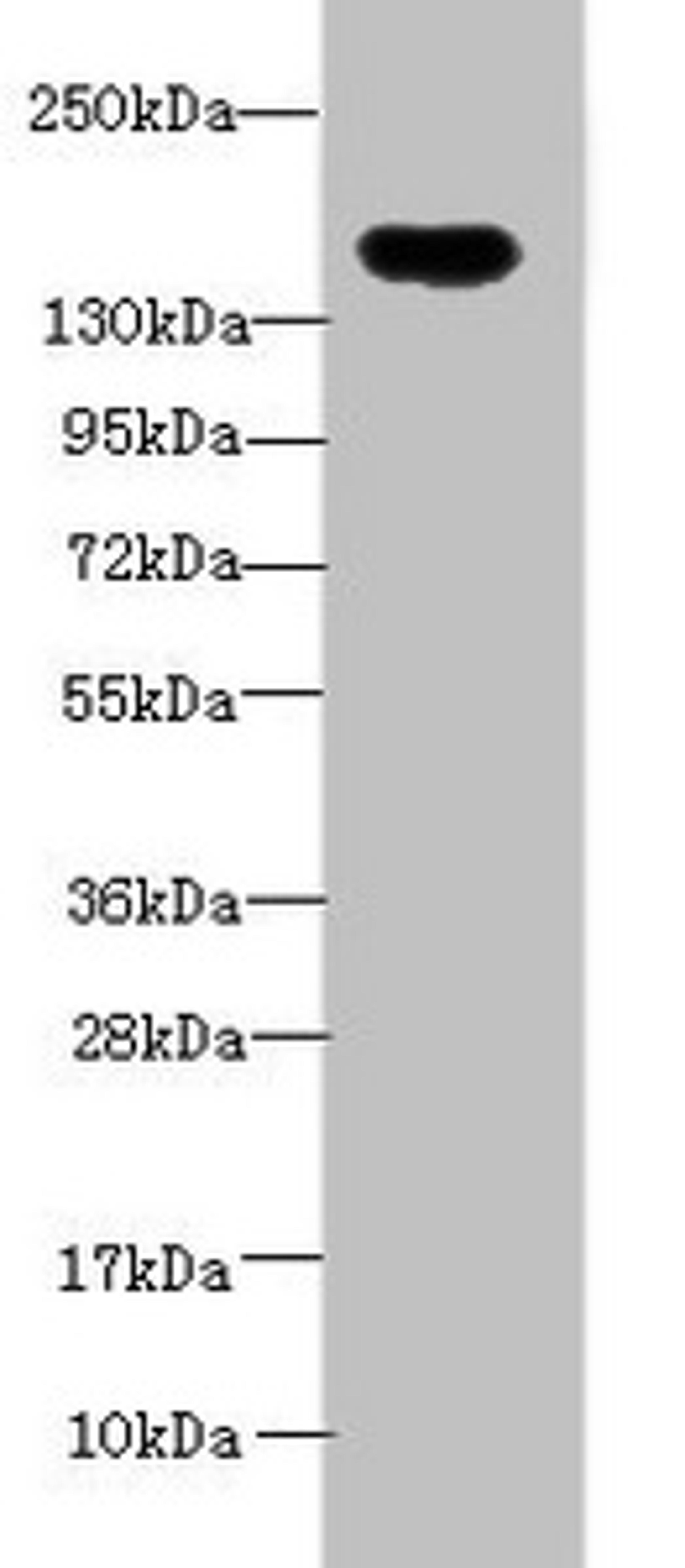 Western blot. All lanes: ADAMTS7 antibody at 2ug/ml + Mouse brain tissue. Secondary. Goat polyclonal to rabbit IgG at 1/10000 dilution. Predicted band size: 184 kDa. Observed band size: 184 kDa. 