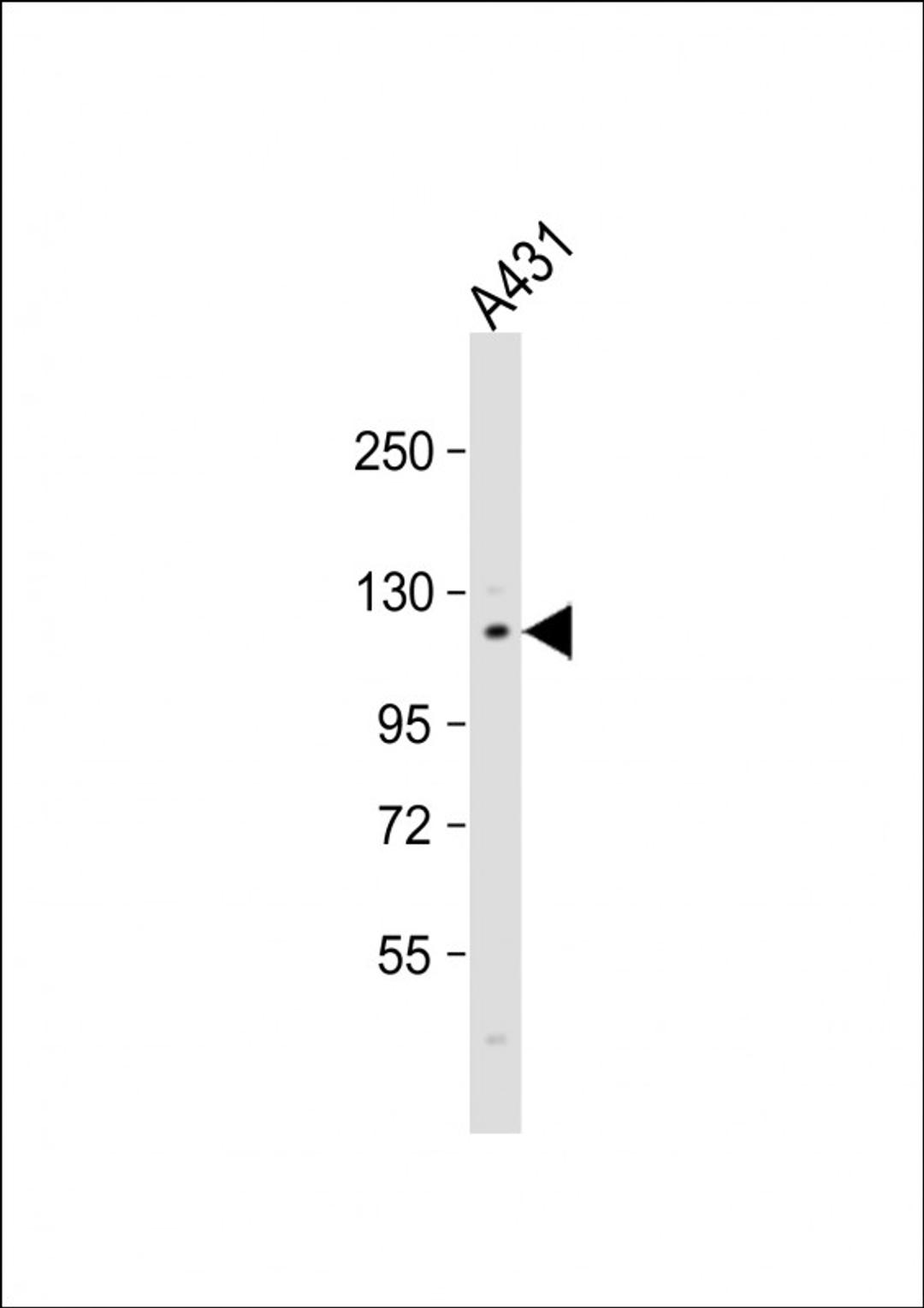 Western Blot at 1:1000 dilution + A431 whole cell lysate Lysates/proteins at 20 ug per lane.