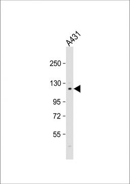 Western Blot at 1:1000 dilution + A431 whole cell lysate Lysates/proteins at 20 ug per lane.