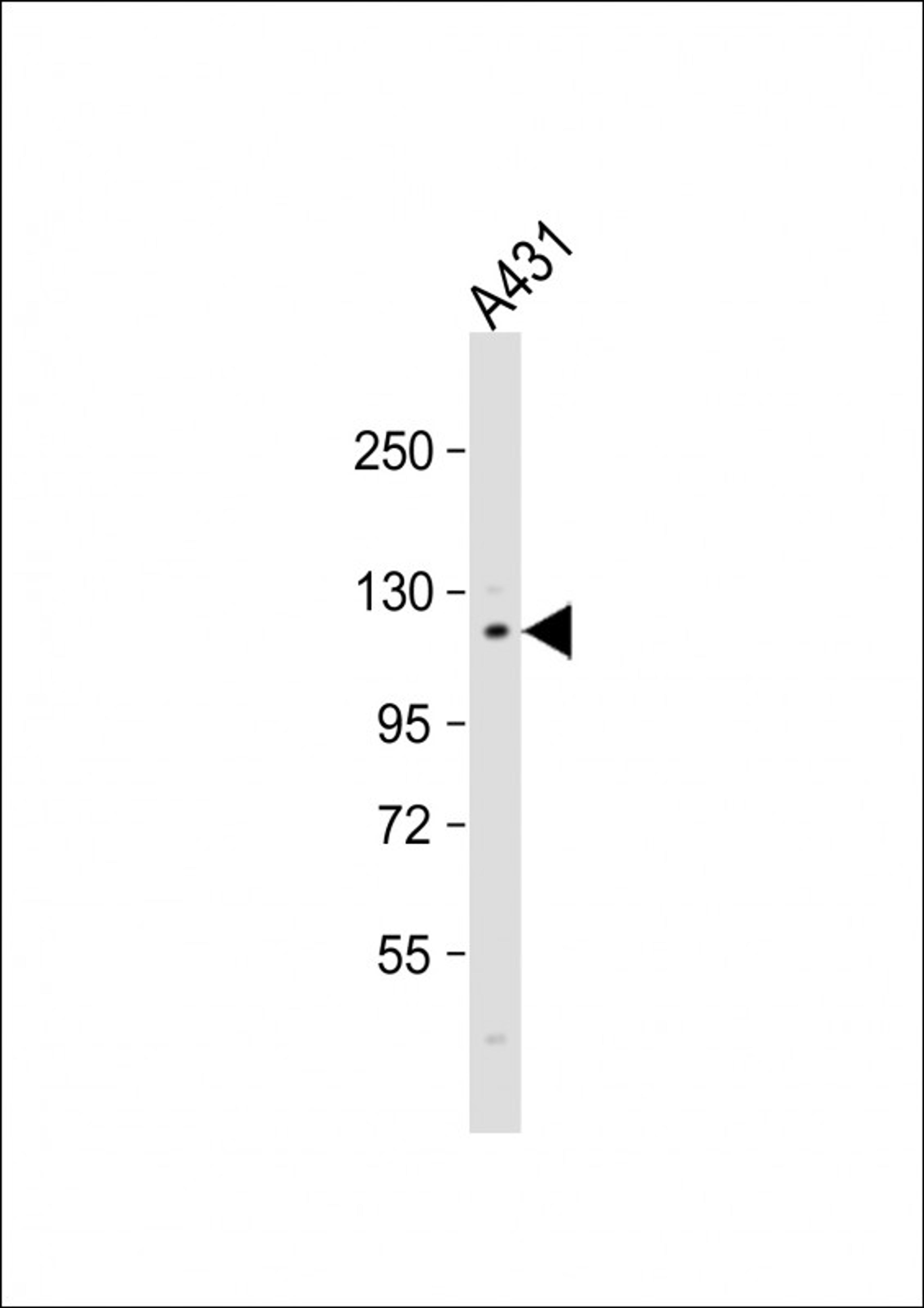 Western Blot at 1:1000 dilution + A431 whole cell lysate Lysates/proteins at 20 ug per lane.