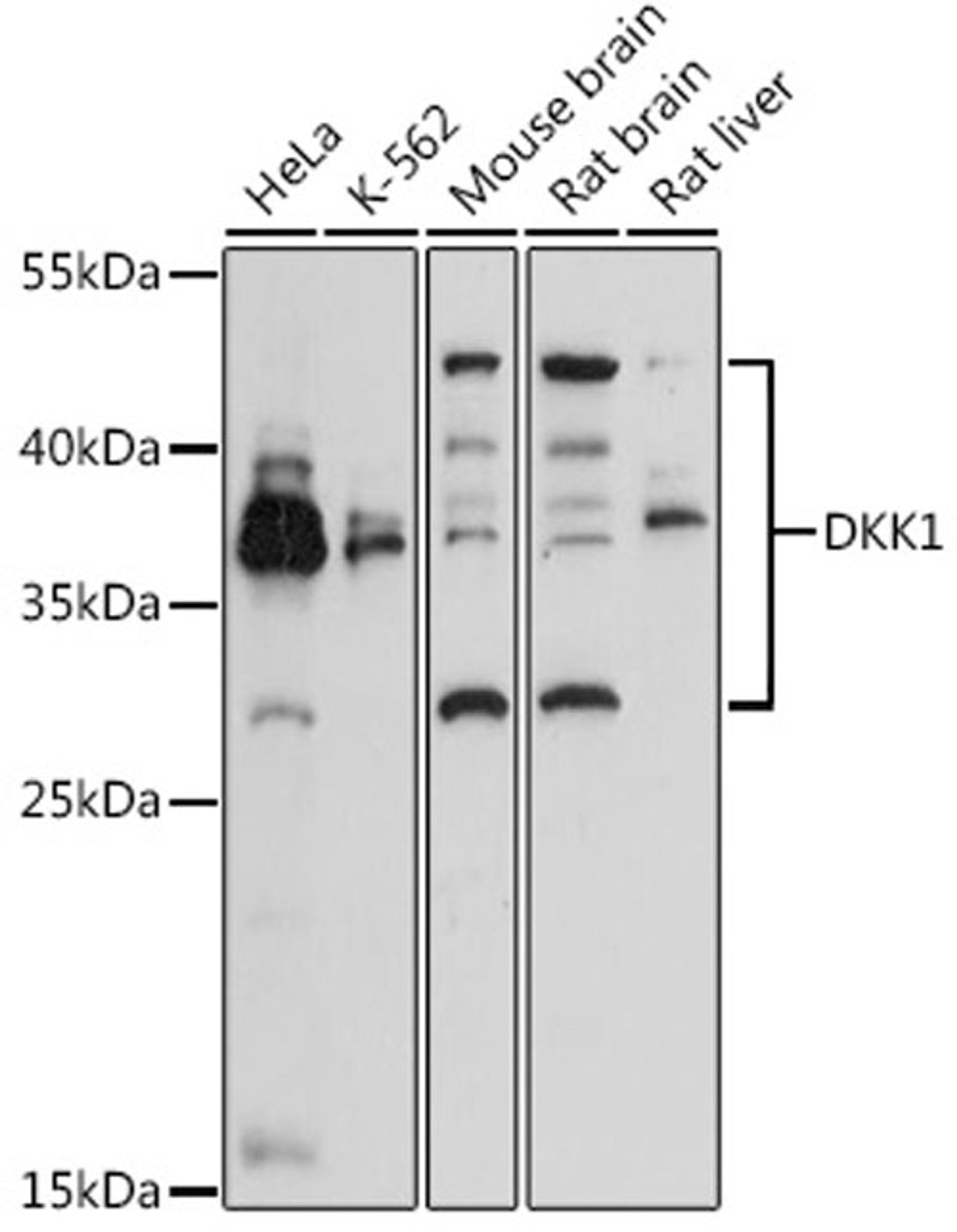 Western blot - DKK1 antibody (A2562)