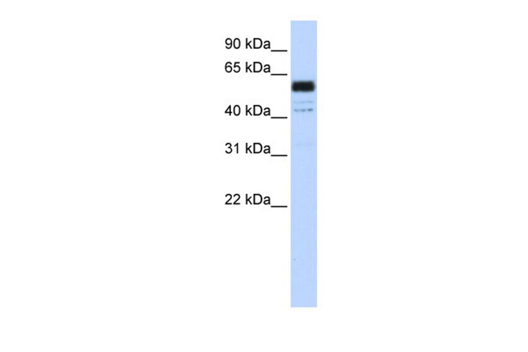 Antibody used in WB on Human Jurkat cells at 0.2-1 ug/ml.