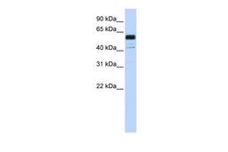 Antibody used in WB on Human Jurkat cells at 0.2-1 ug/ml.