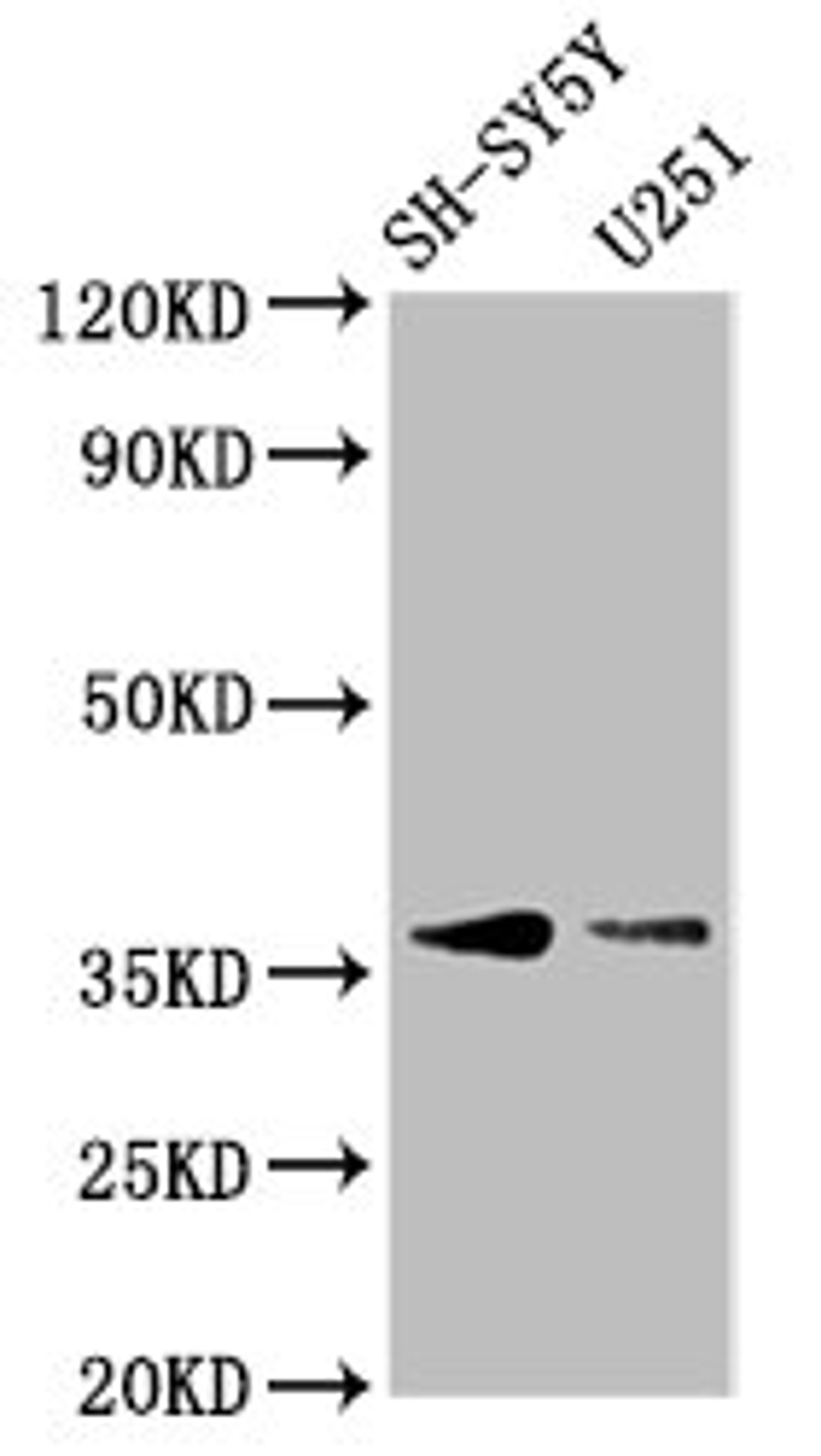 Western Blot. Positive WB detected in: SH-SY5Y whole cell lysate, U251 whole cell lysate. All lanes: BARHL1 antibody at 3.4µg/ml. Secondary. Goat polyclonal to rabbit IgG at 1/50000 dilution. Predicted band size: 36 kDa. Observed band size: 36 kDa