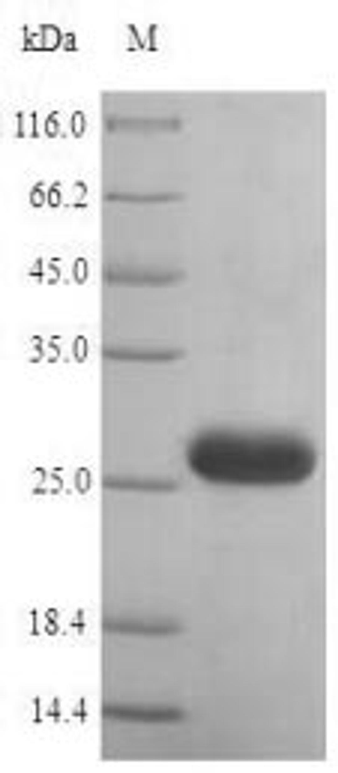 (Tris-Glycine gel) Discontinuous SDS-PAGE (reduced) with 5% enrichment gel and 15% separation gel.