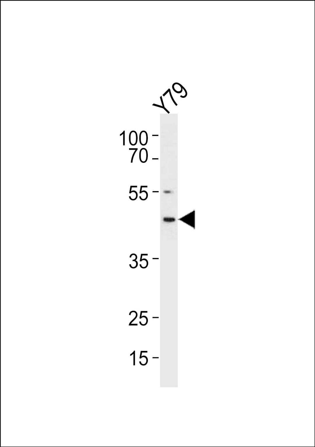 Western blot analysis in Y79 cell line lysates (35ug/lane).