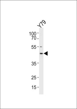 Western blot analysis in Y79 cell line lysates (35ug/lane).