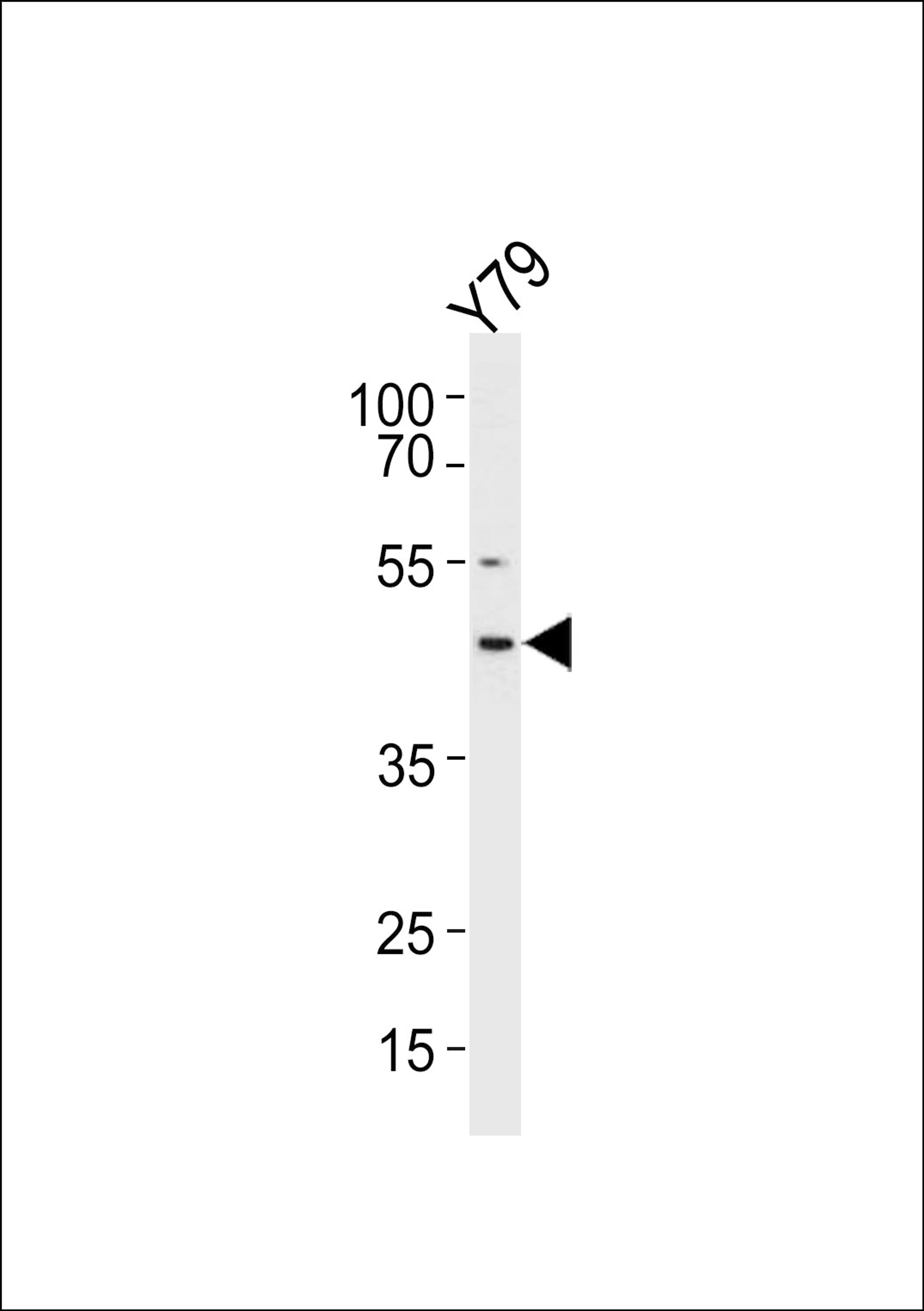 Western blot analysis in Y79 cell line lysates (35ug/lane).