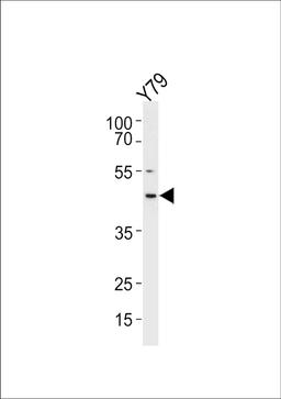 Western blot analysis in Y79 cell line lysates (35ug/lane).